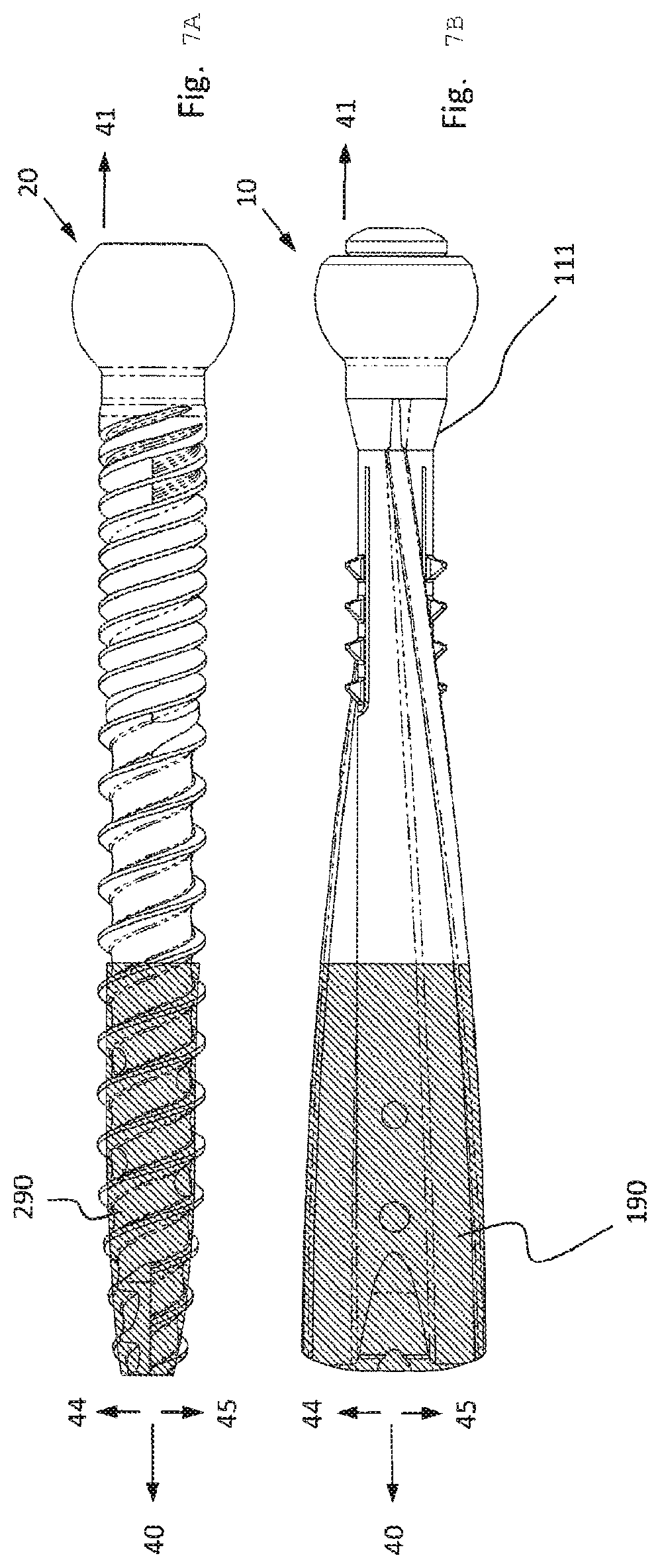 Patent US12376892 Figure 7 – Bone-anchoring device for a pedicle access