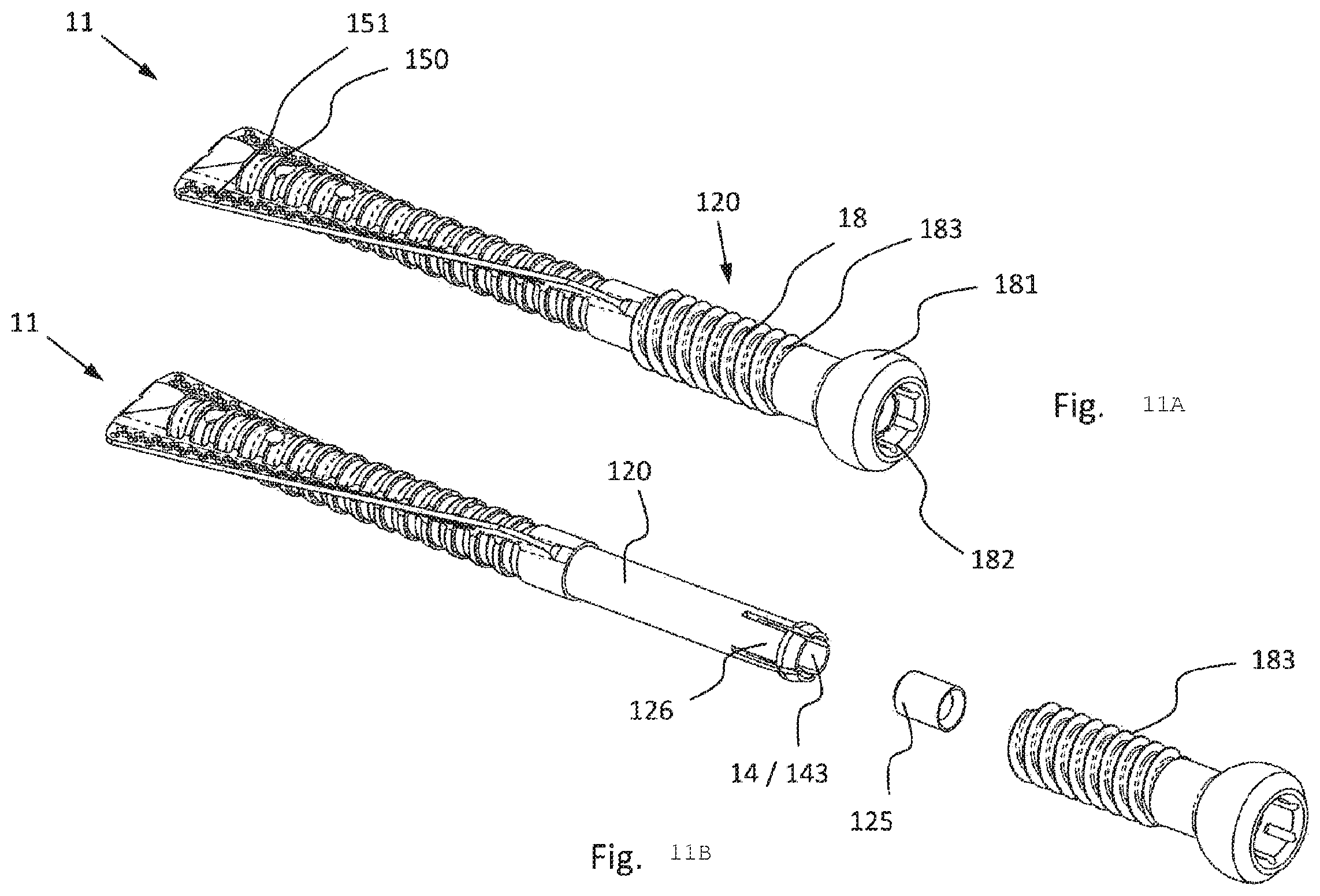 Patent US12376892 Figure 11 – Bone-anchoring device for a pedicle access