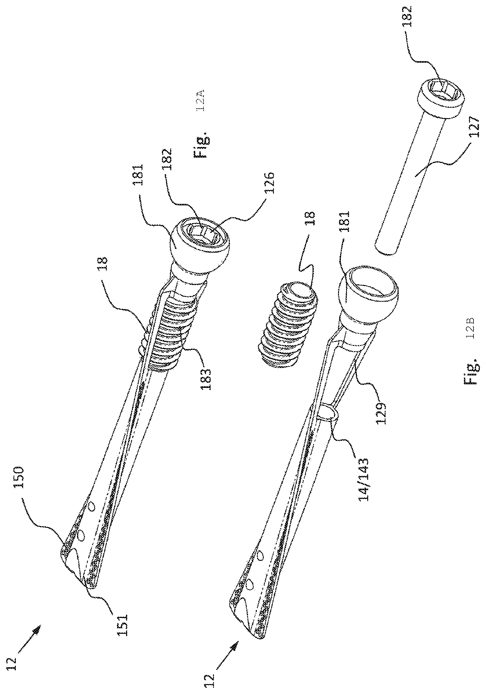 Patent US12376892 Figure 12 – Bone-anchoring device for a pedicle access
