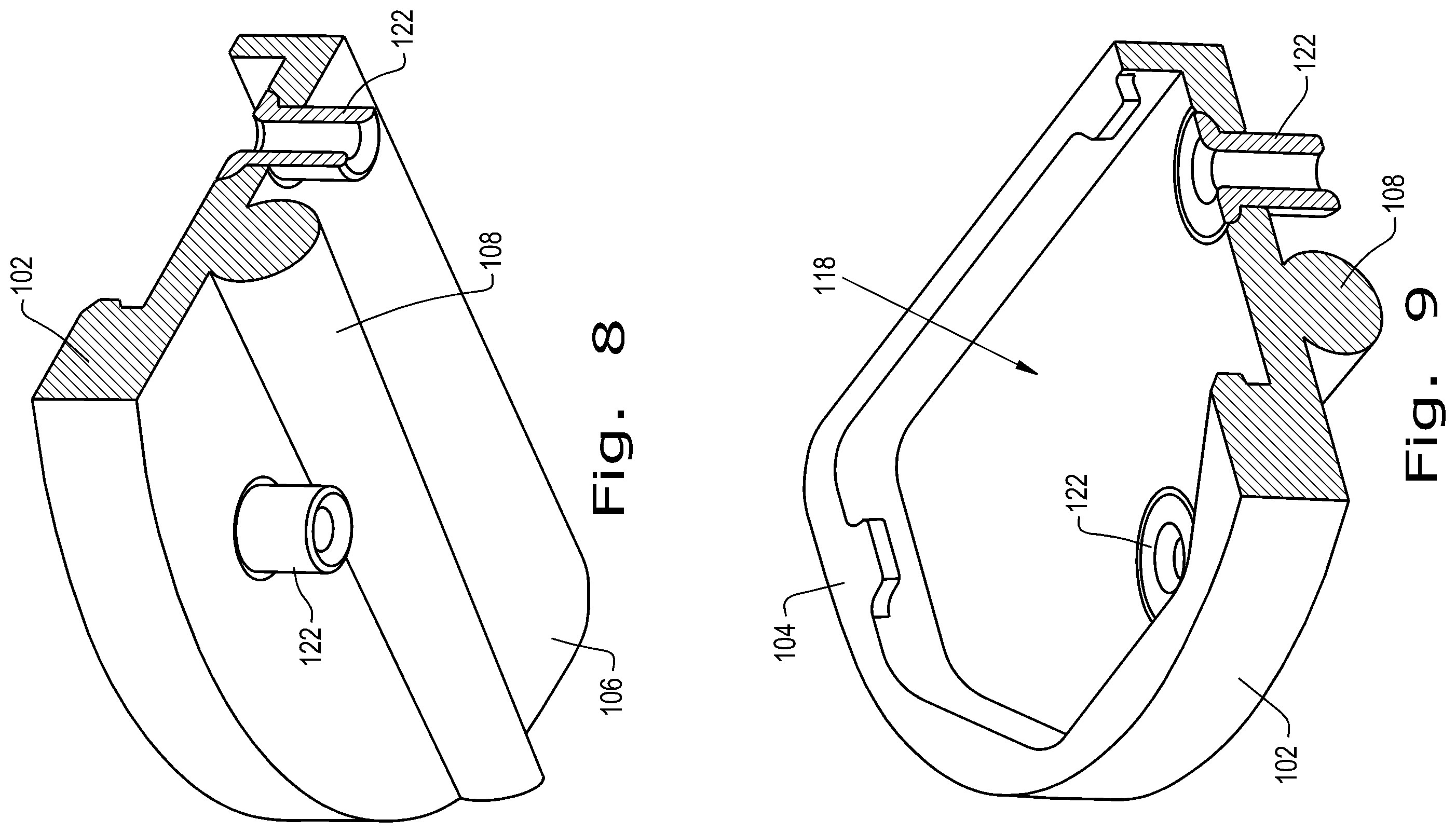 Patent US12376893 Figure 4 – Orthopaedic implant with fixation feature and a method of implanting thereof