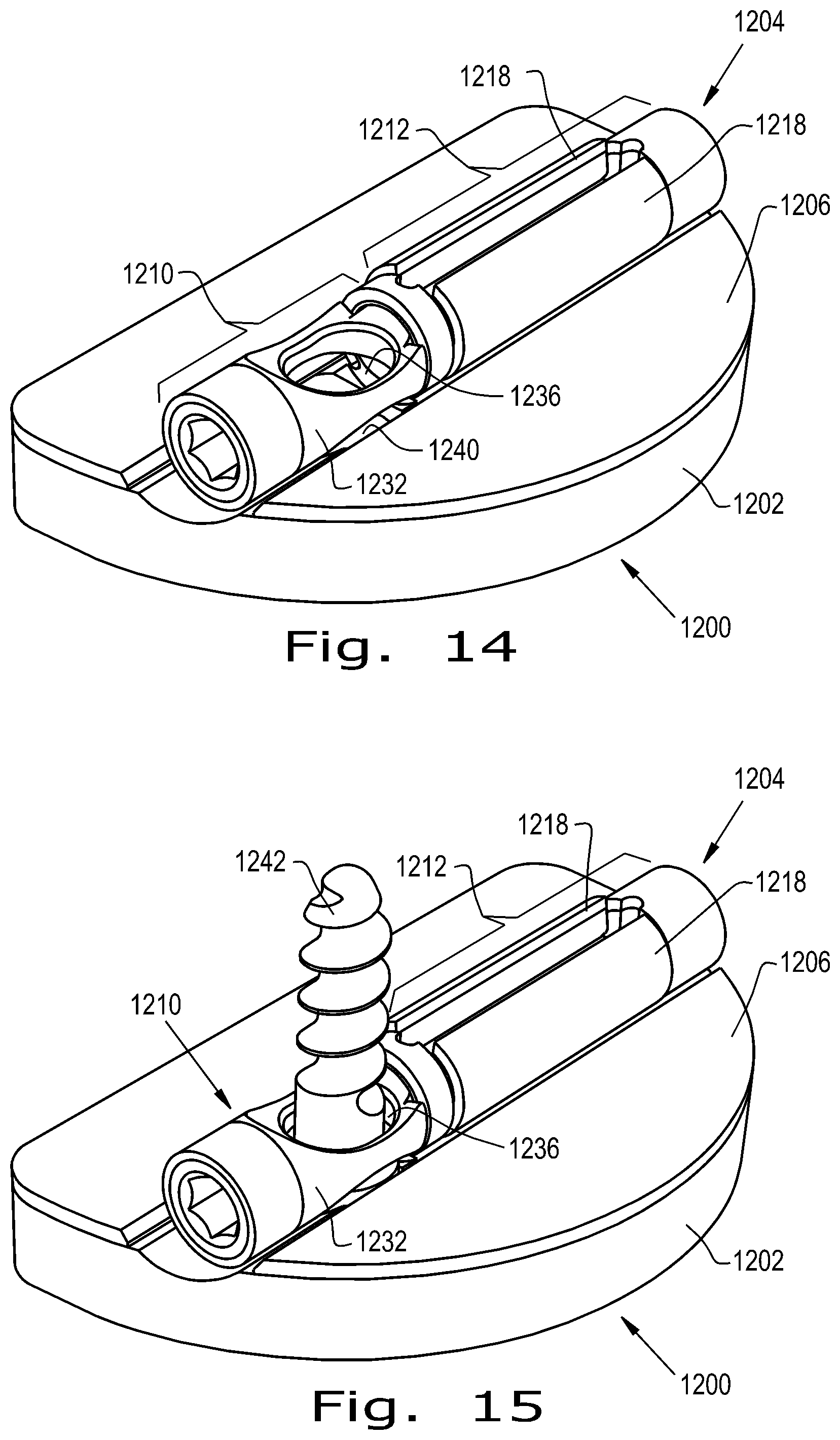 Patent US12376893 Figure 7 – Orthopaedic implant with fixation feature and a method of implanting thereof