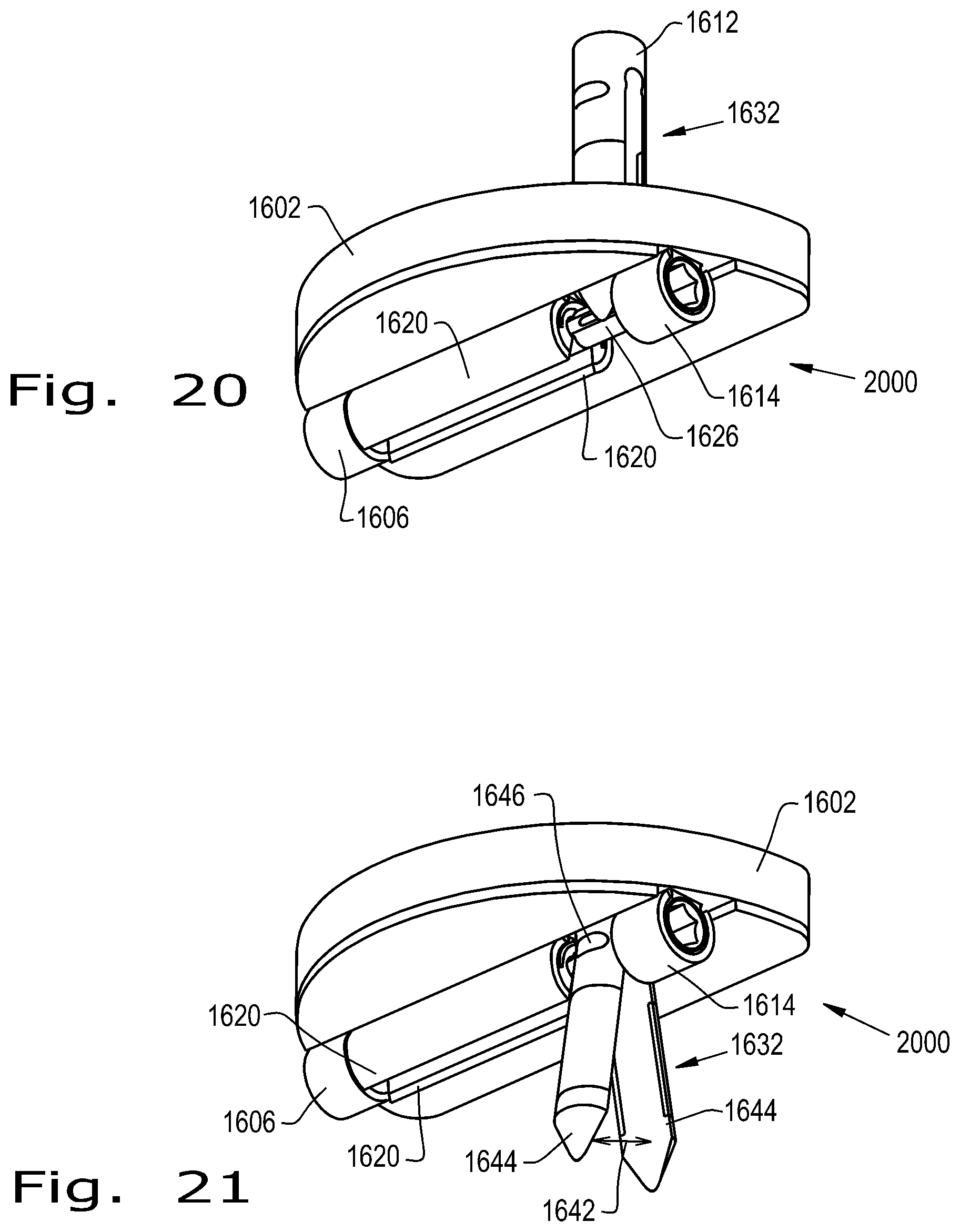 Patent US12376893 Figure 10 – Orthopaedic implant with fixation feature and a method of implanting thereof