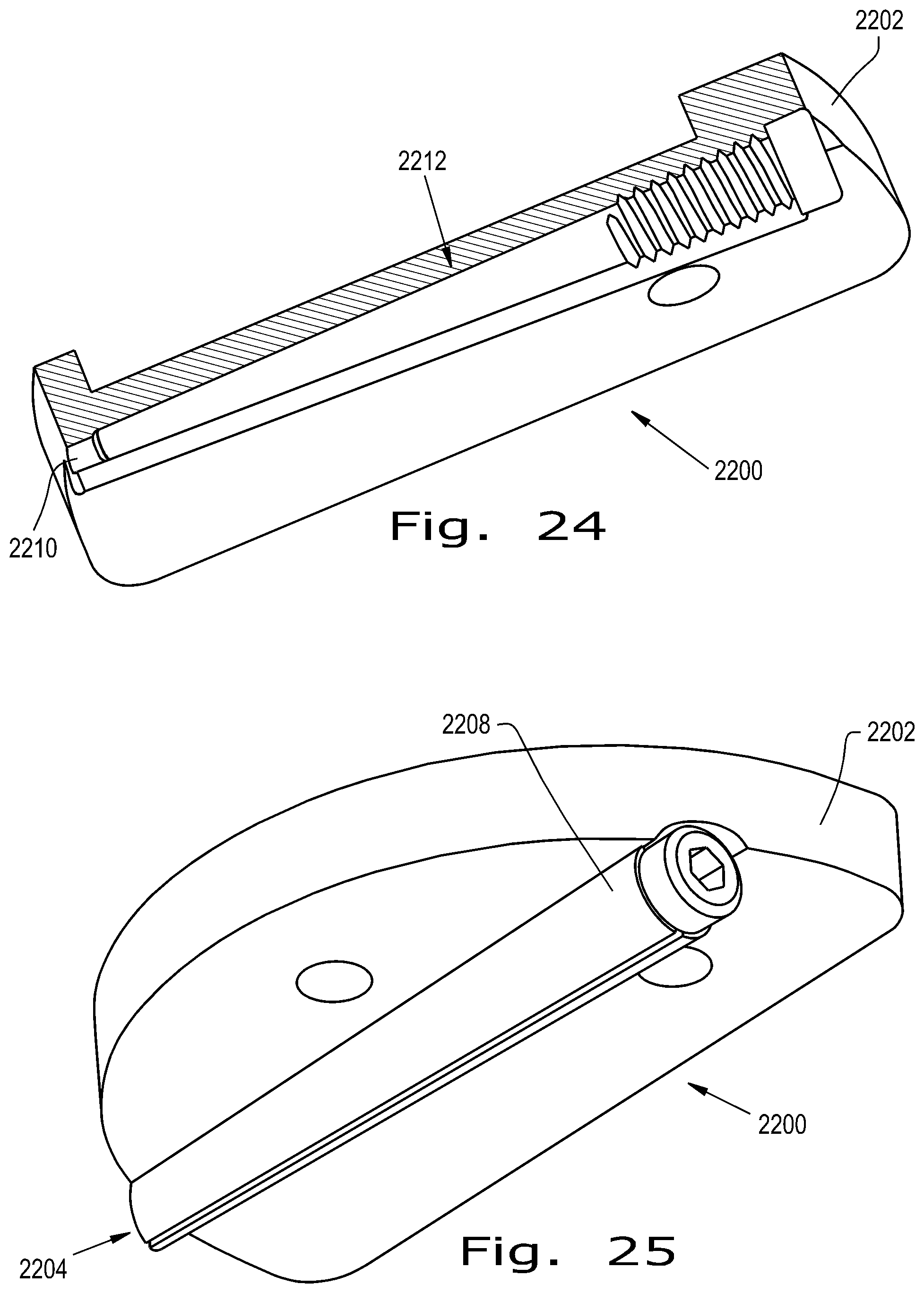 Patent US12376893 Figure 12 – Orthopaedic implant with fixation feature and a method of implanting thereof