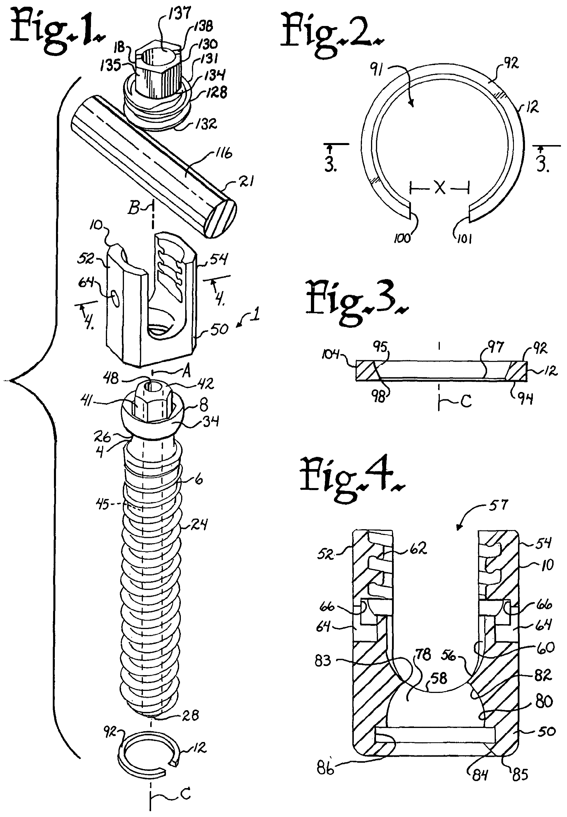 Patent US12376894 Figure 1 – Pivotal bone anchor assembly with ring retainer and twist-in-place pressure insert