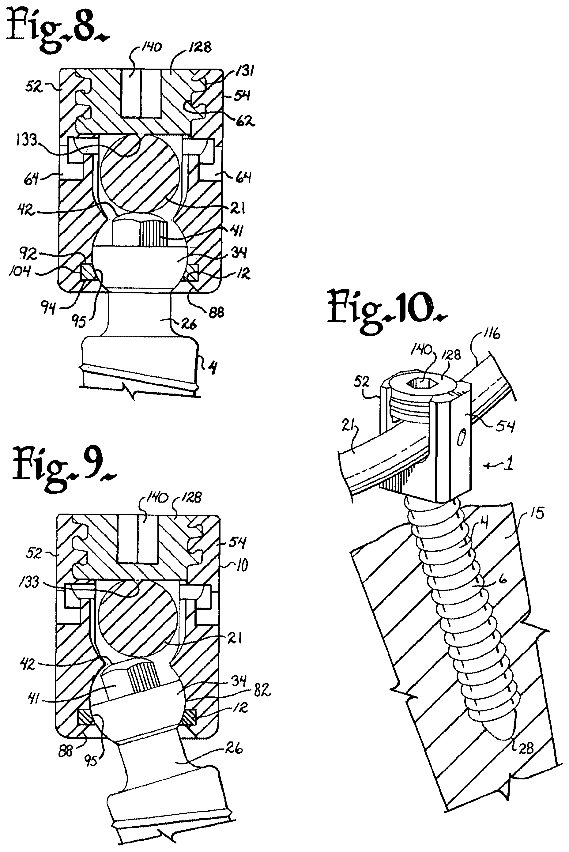Patent US12376894 Figure 3 – Pivotal bone anchor assembly with ring retainer and twist-in-place pressure insert