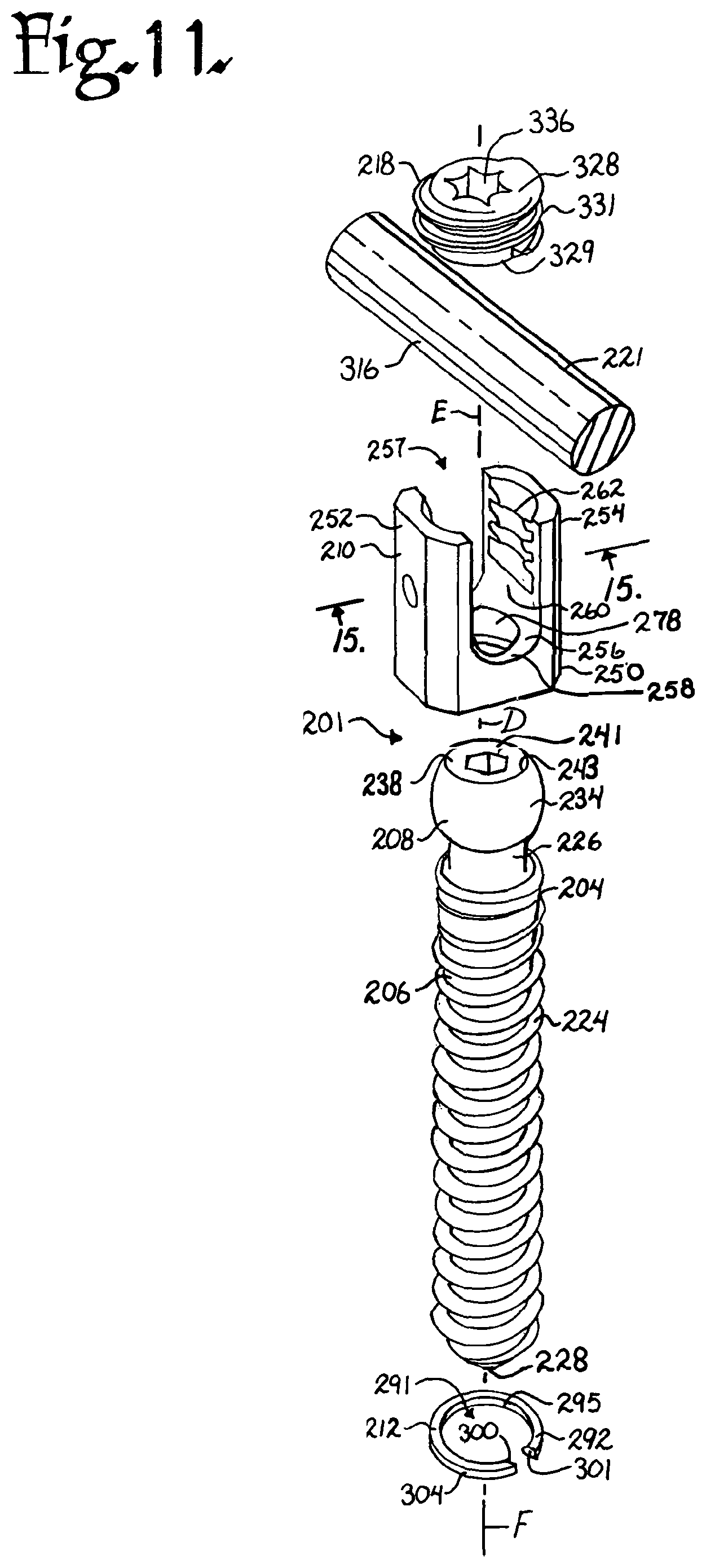 Patent US12376894 Figure 4 – Pivotal bone anchor assembly with ring retainer and twist-in-place pressure insert