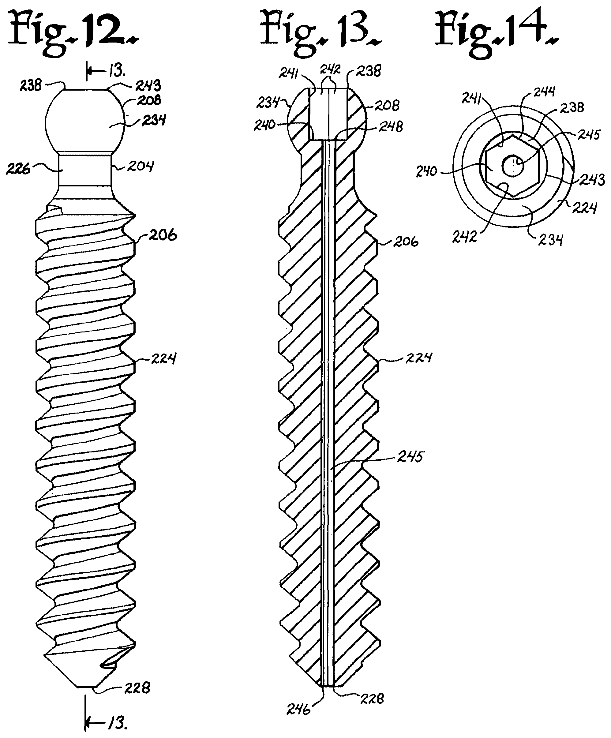 Patent US12376894 Figure 5 – Pivotal bone anchor assembly with ring retainer and twist-in-place pressure insert