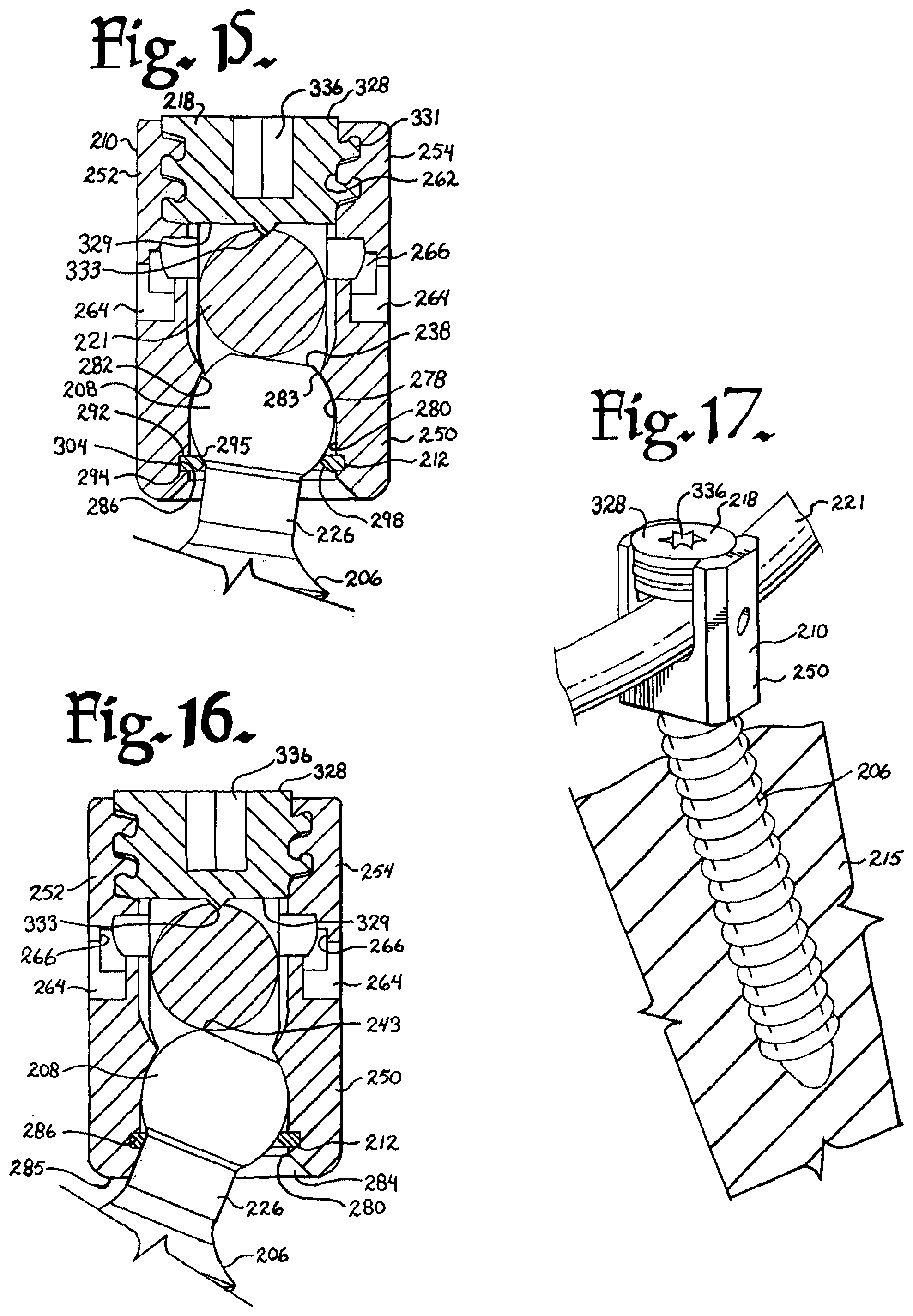 Patent US12376894 Figure 6 – Pivotal bone anchor assembly with ring retainer and twist-in-place pressure insert