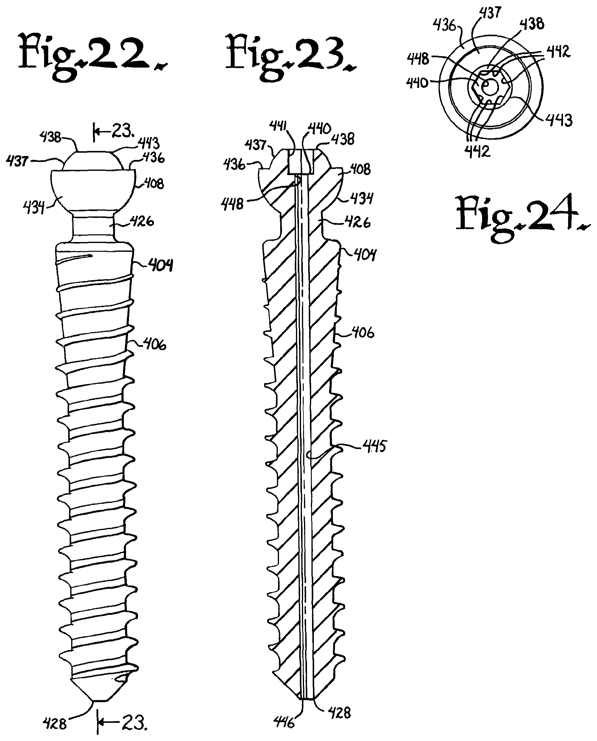 Patent US12376894 Figure 8 – Pivotal bone anchor assembly with ring retainer and twist-in-place pressure insert