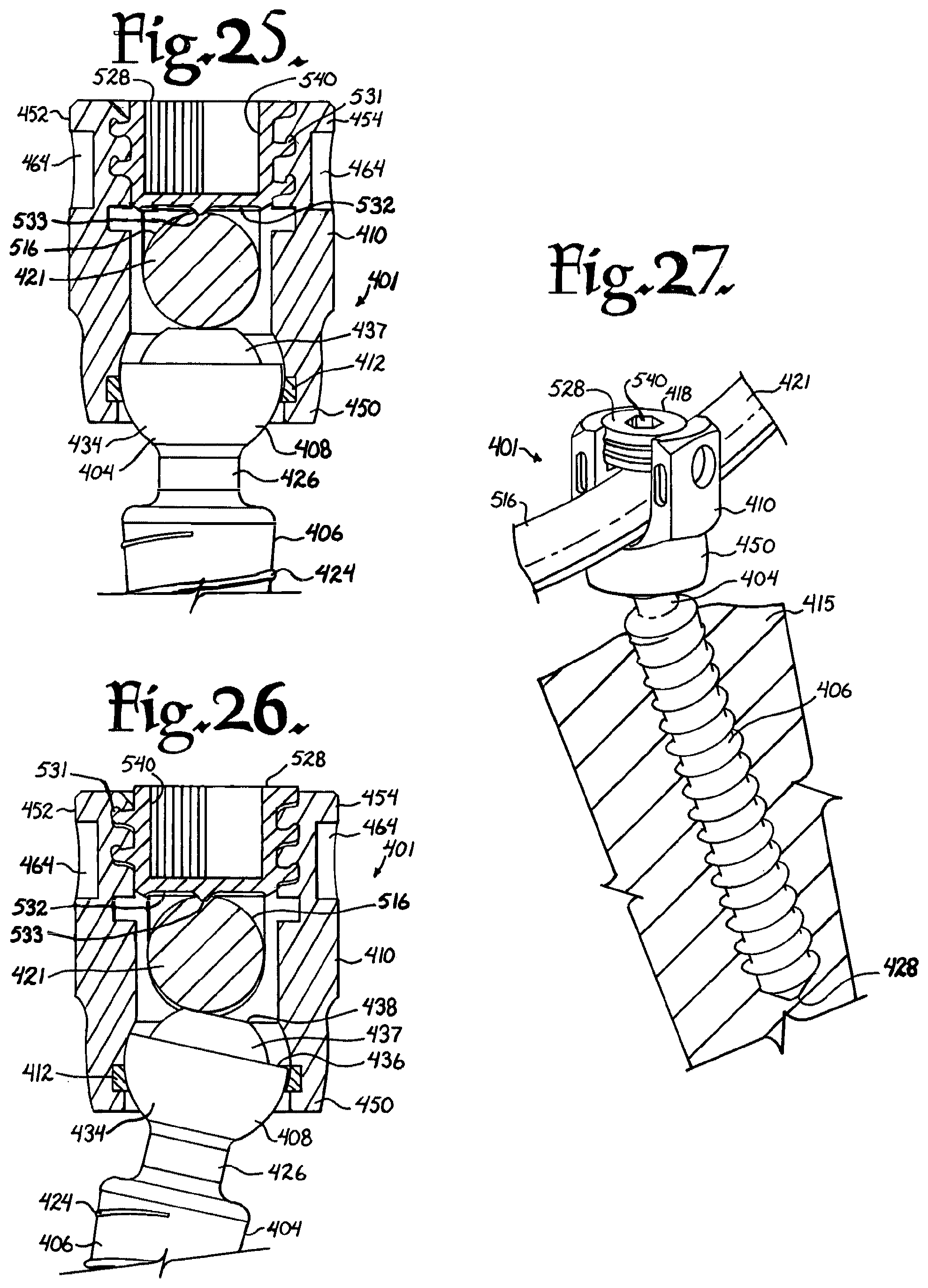 Patent US12376894 Figure 9 – Pivotal bone anchor assembly with ring retainer and twist-in-place pressure insert