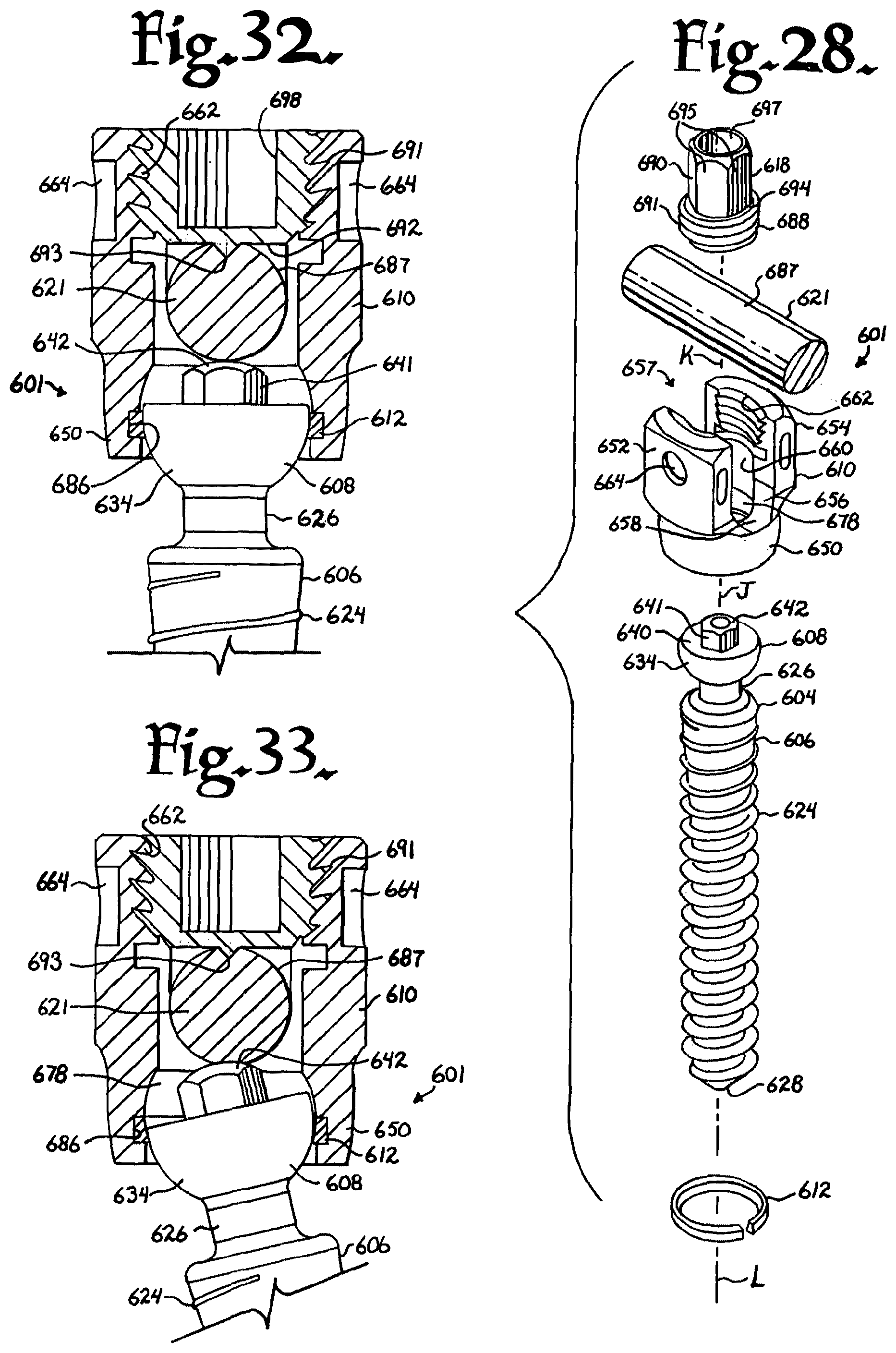 Patent US12376894 Figure 10 – Pivotal bone anchor assembly with ring retainer and twist-in-place pressure insert