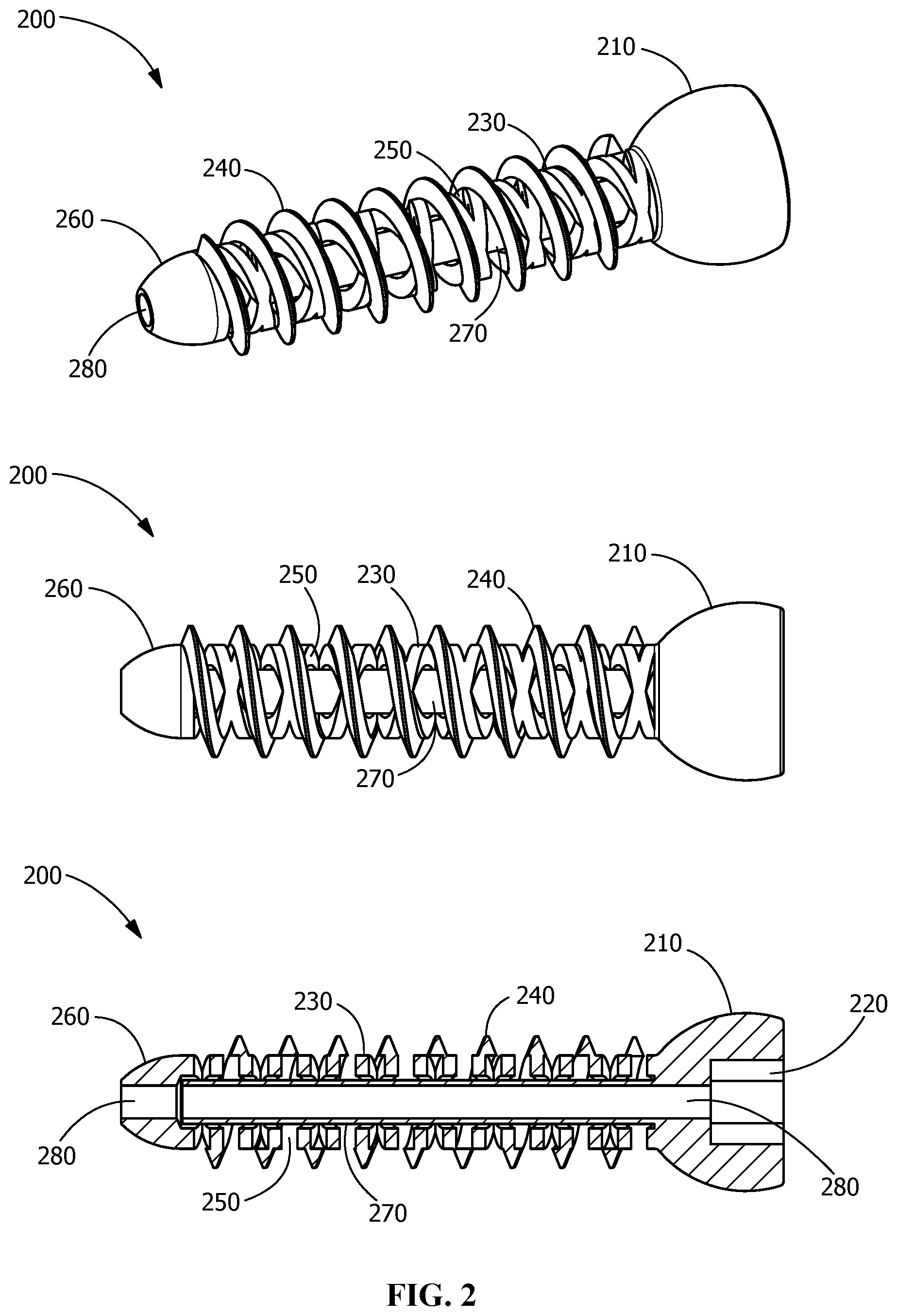 Patent US12376895 Figure 2 – Implants for tissue fixation and fusion