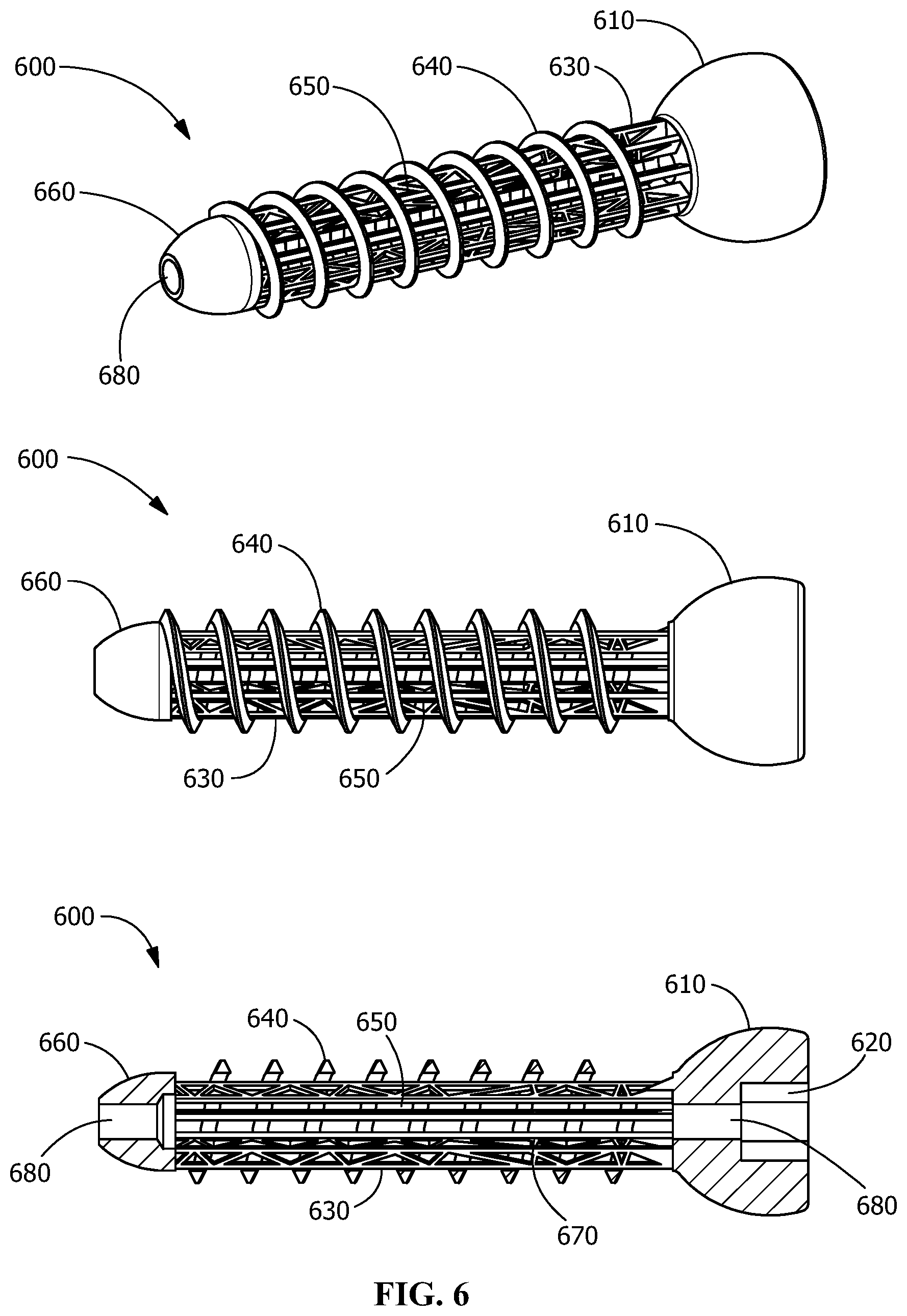 Patent US12376895 Figure 6 – Implants for tissue fixation and fusion