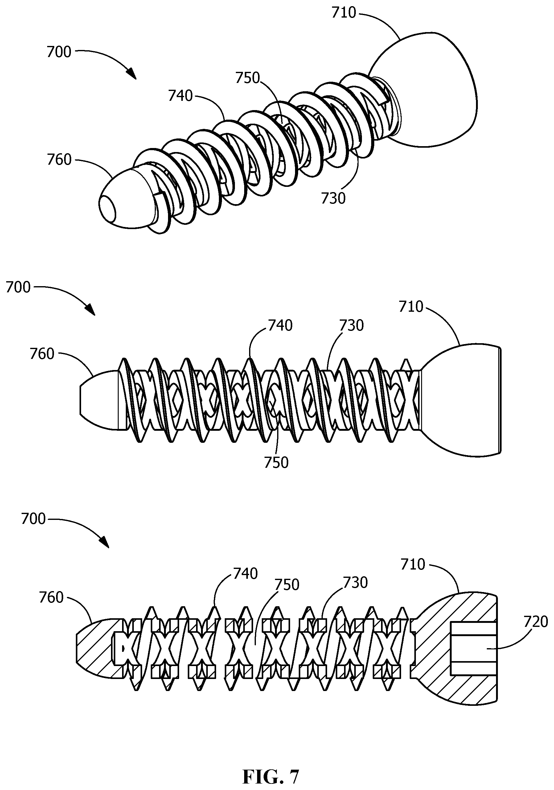 Patent US12376895 Figure 7 – Implants for tissue fixation and fusion
