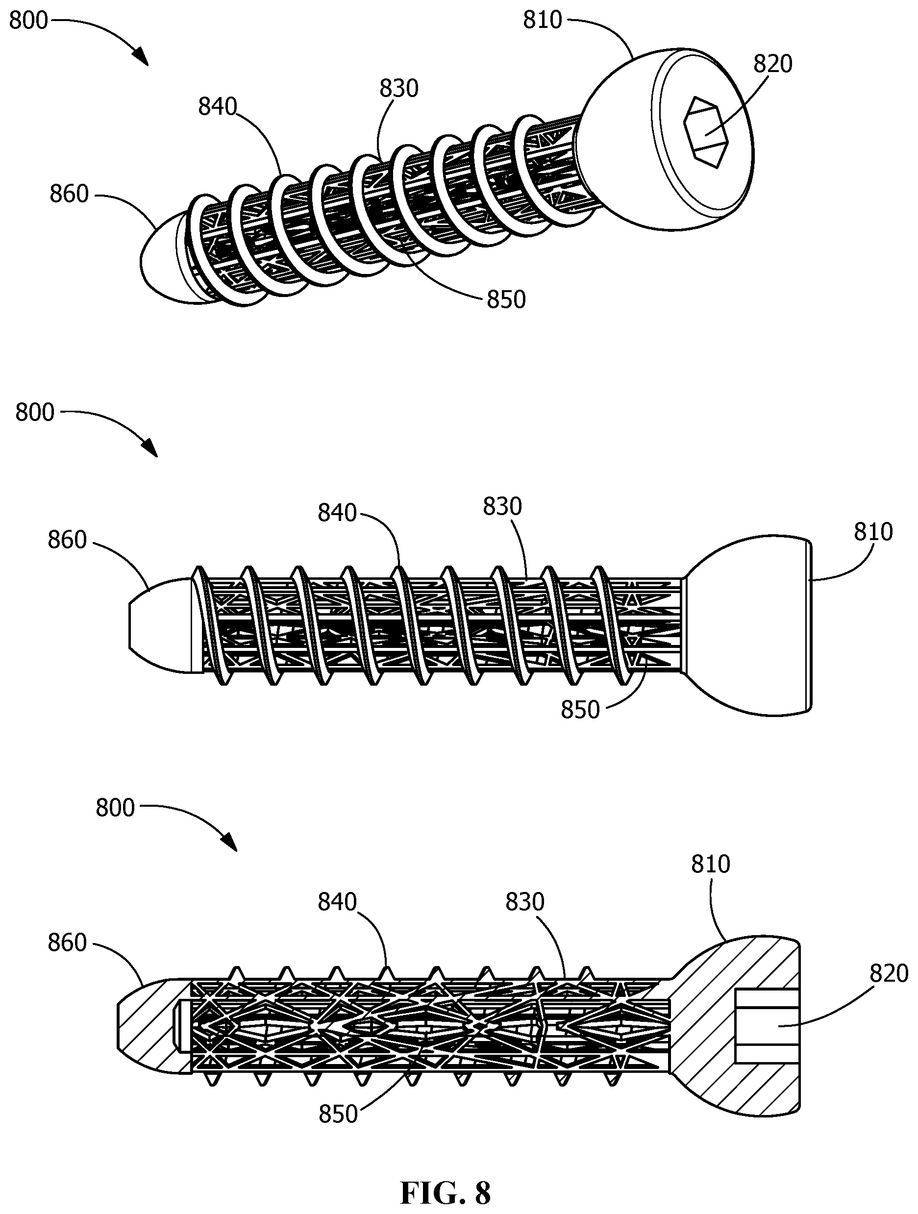 Patent US12376895 Figure 8 – Implants for tissue fixation and fusion