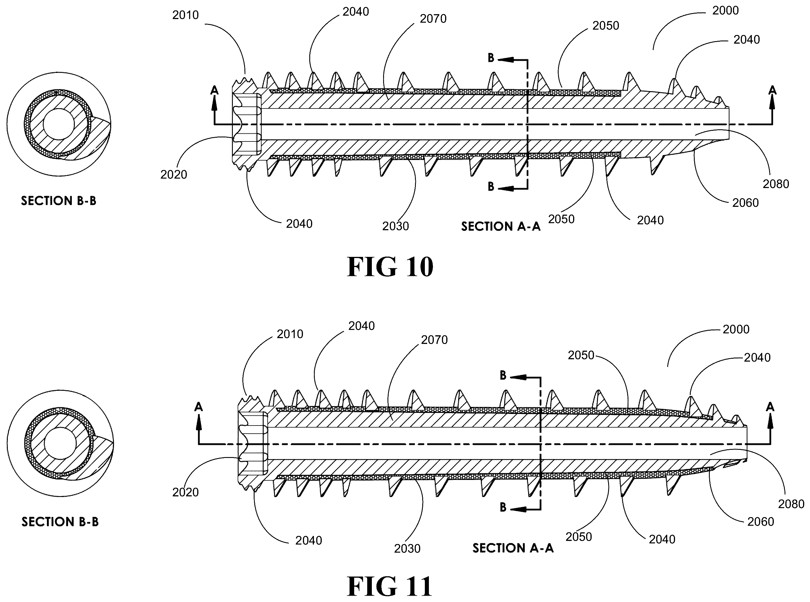 Patent US12376895 Figure 11 – Implants for tissue fixation and fusion