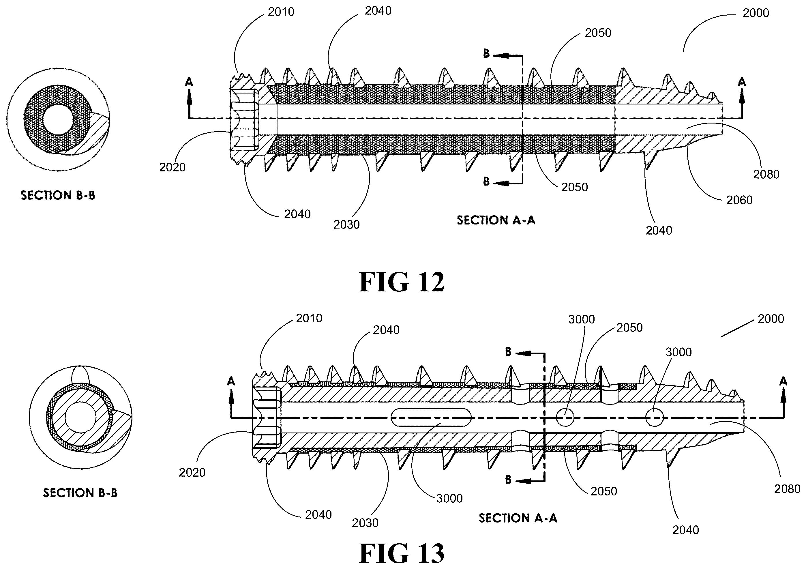 Patent US12376895 Figure 12 – Implants for tissue fixation and fusion