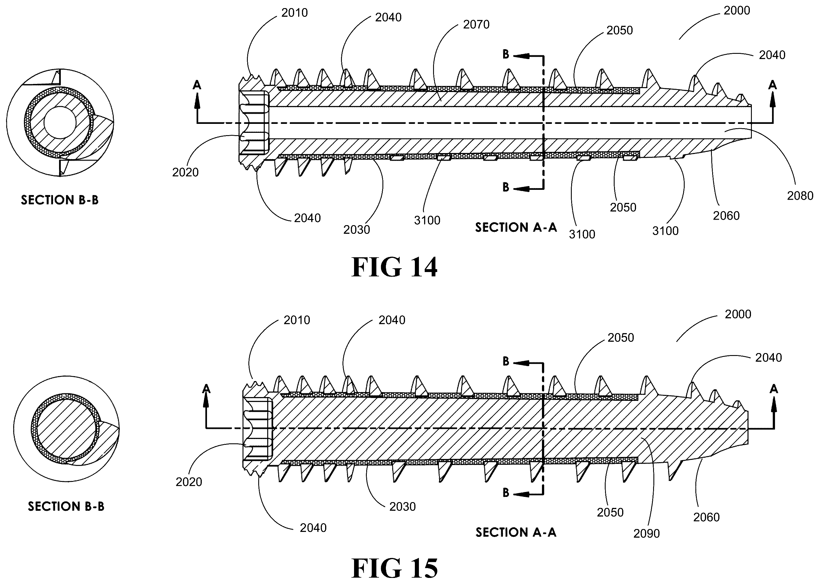 Patent US12376895 Figure 13 – Implants for tissue fixation and fusion