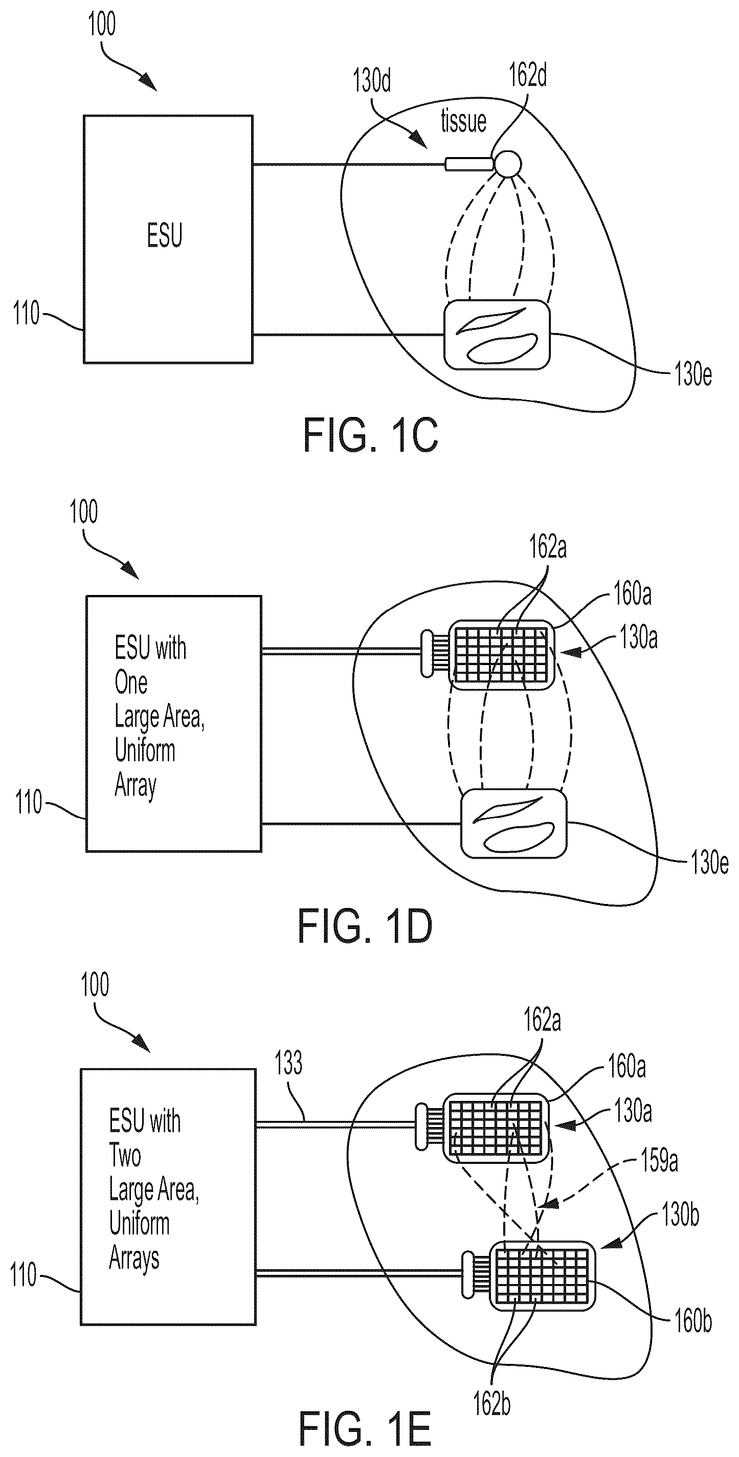 Patent US12376898 Figure 3 – Non-invasive, uniform and non-uniform RF methods and systems related applications