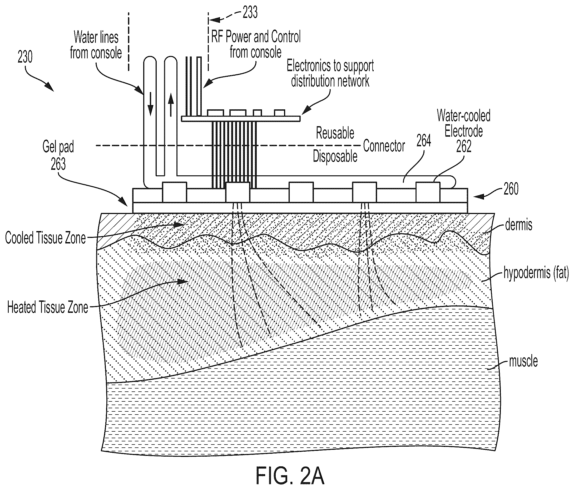 Patent US12376898 Figure 9 – Non-invasive, uniform and non-uniform RF methods and systems related applications