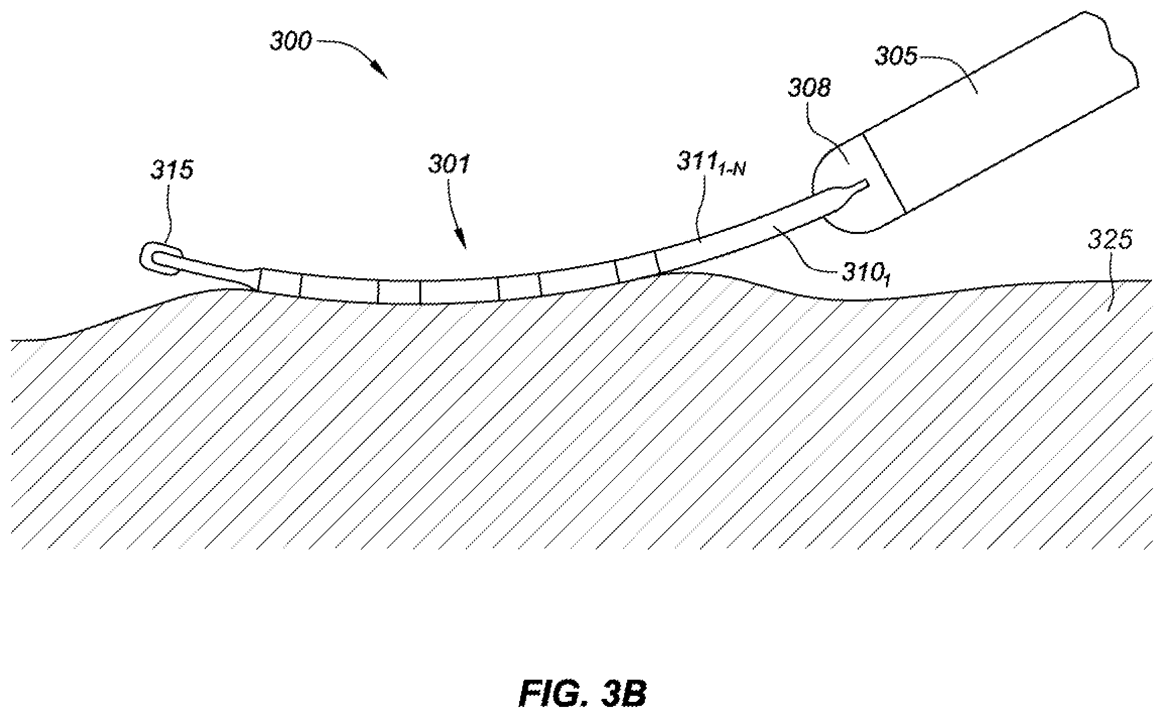 Patent US12376901 Figure 5 – Radio-frequency ablation and direct current electroporation catheters