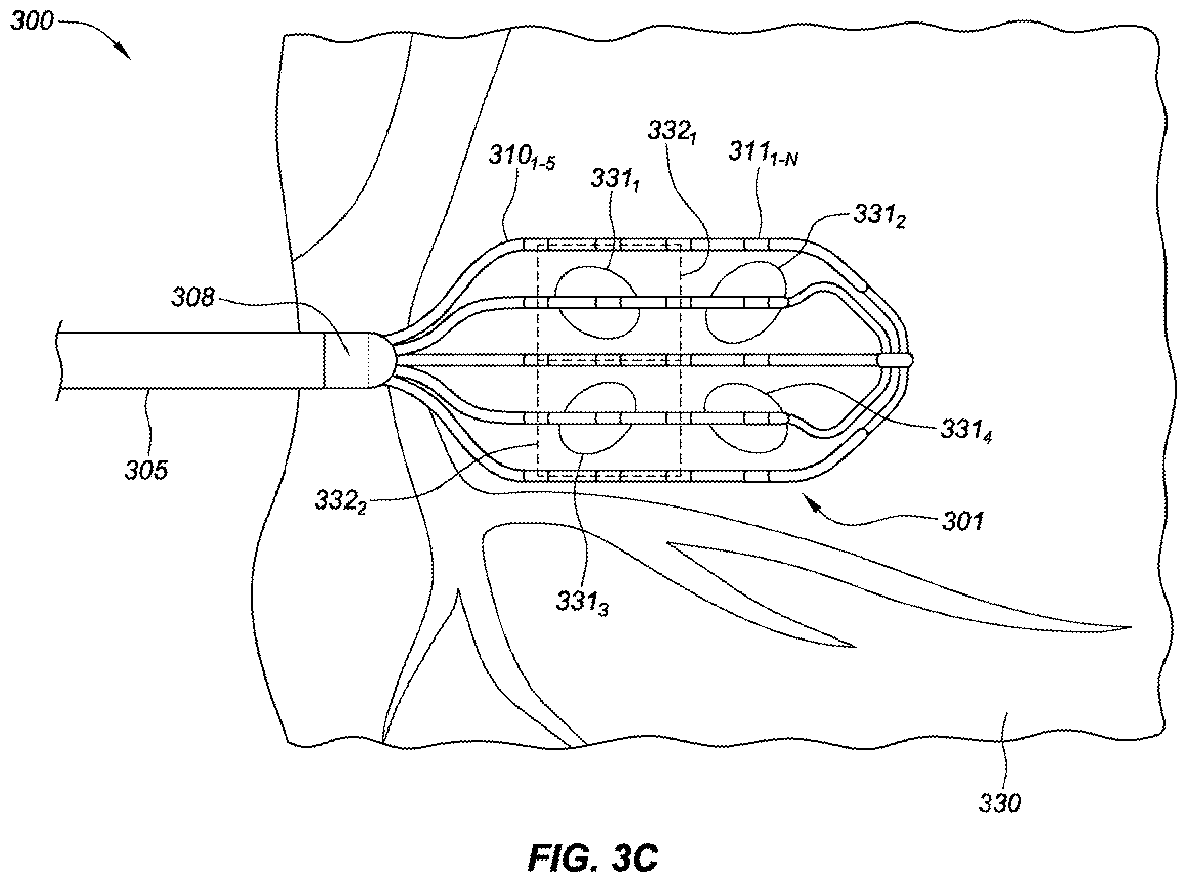 Patent US12376901 Figure 6 – Radio-frequency ablation and direct current electroporation catheters