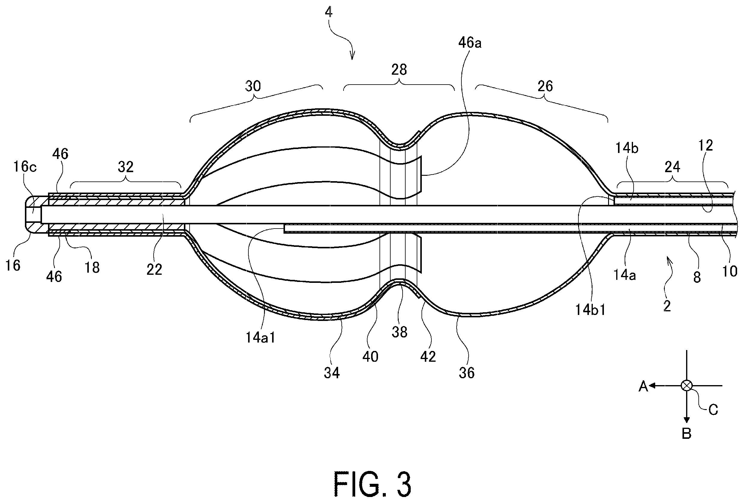 Patent US12376902 Figure 3 – Balloon-type electrode catheter and method of actuating balloon-type electrode catheter