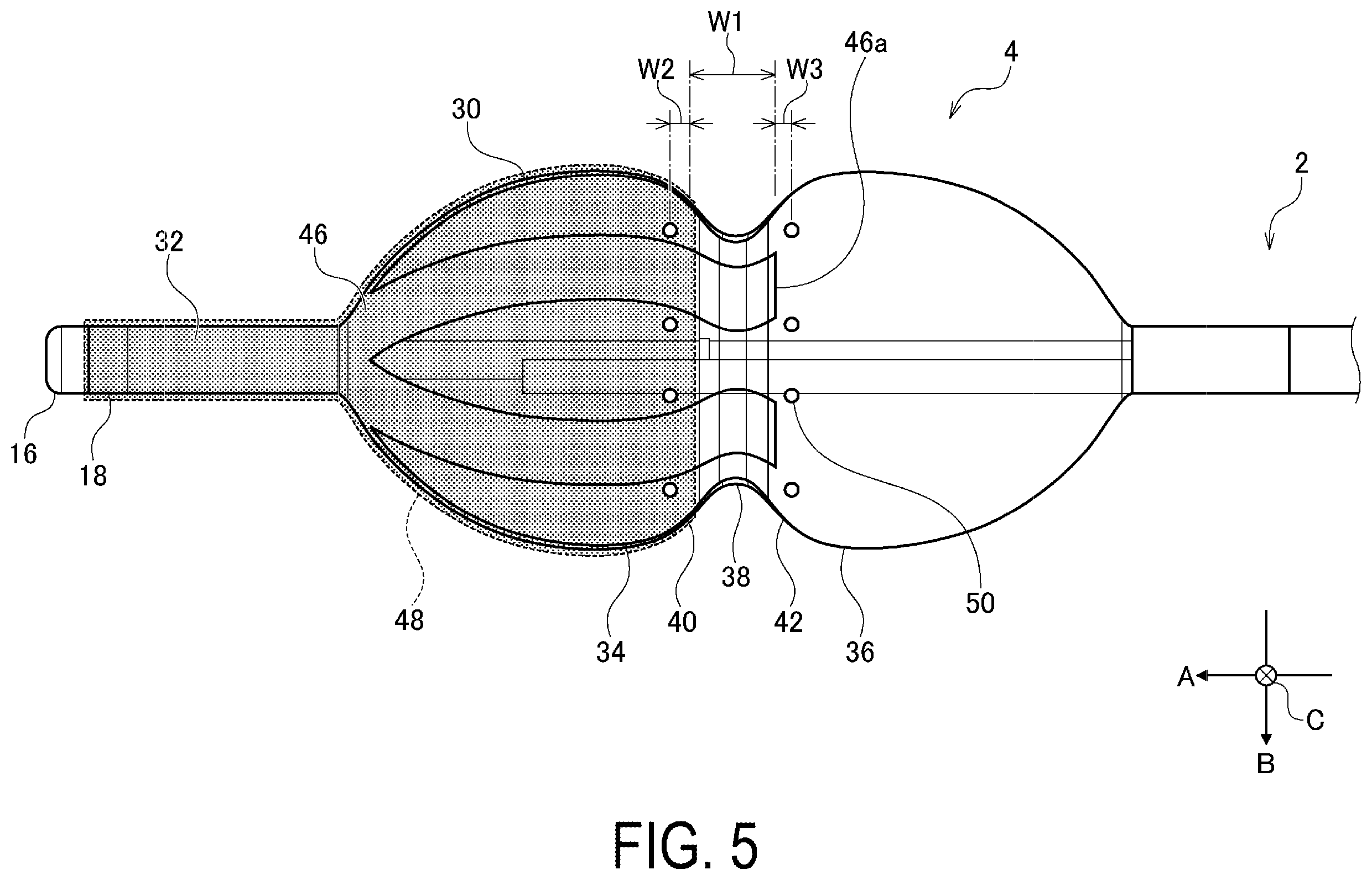 Patent US12376902 Figure 5 – Balloon-type electrode catheter and method of actuating balloon-type electrode catheter