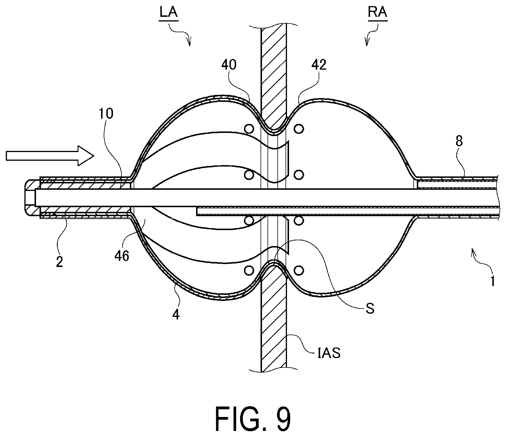 Patent US12376902 Figure 9 – Balloon-type electrode catheter and method of actuating balloon-type electrode catheter