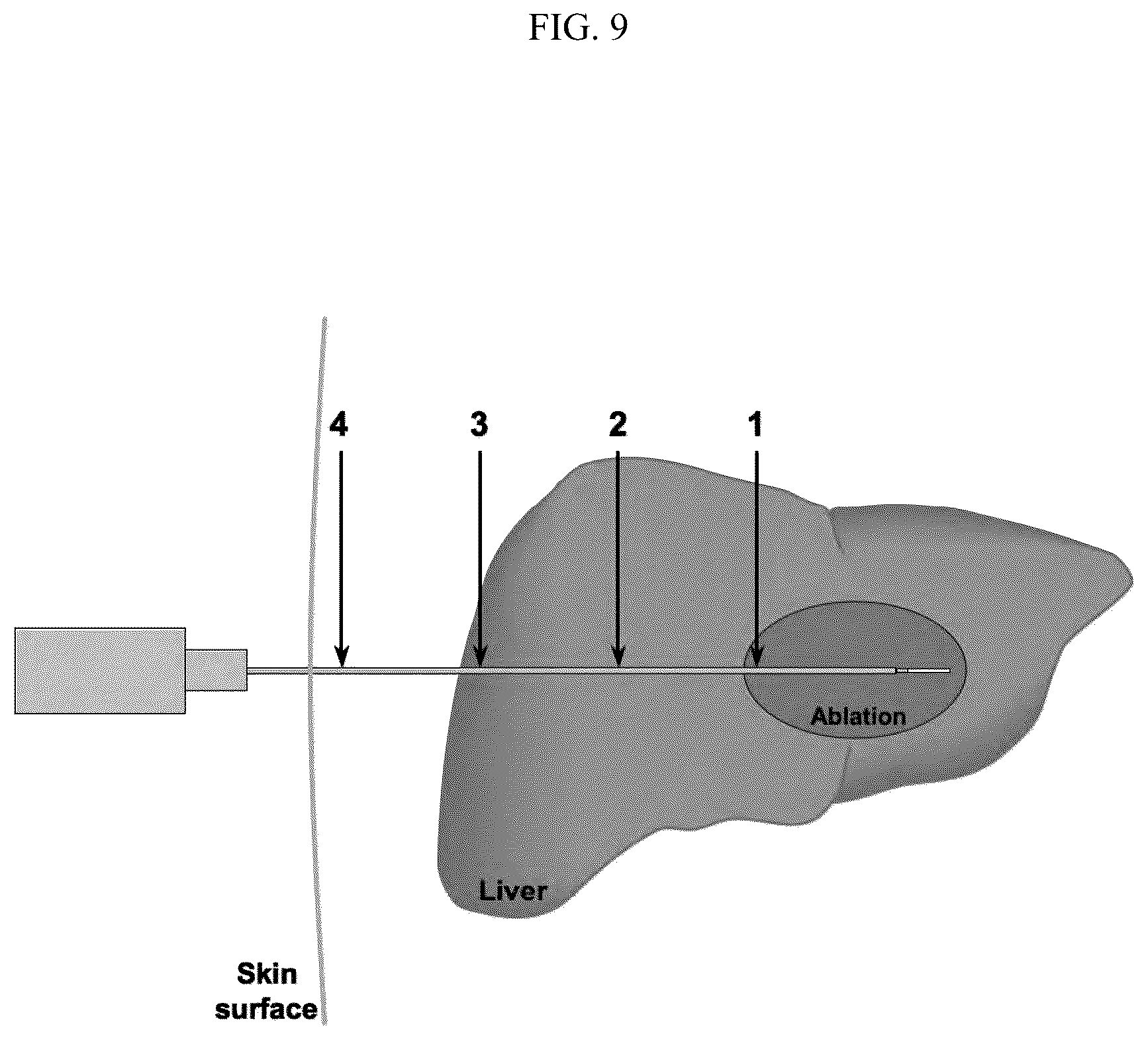 Patent US12376903 Figure 9 – Energy delivery systems and uses thereof