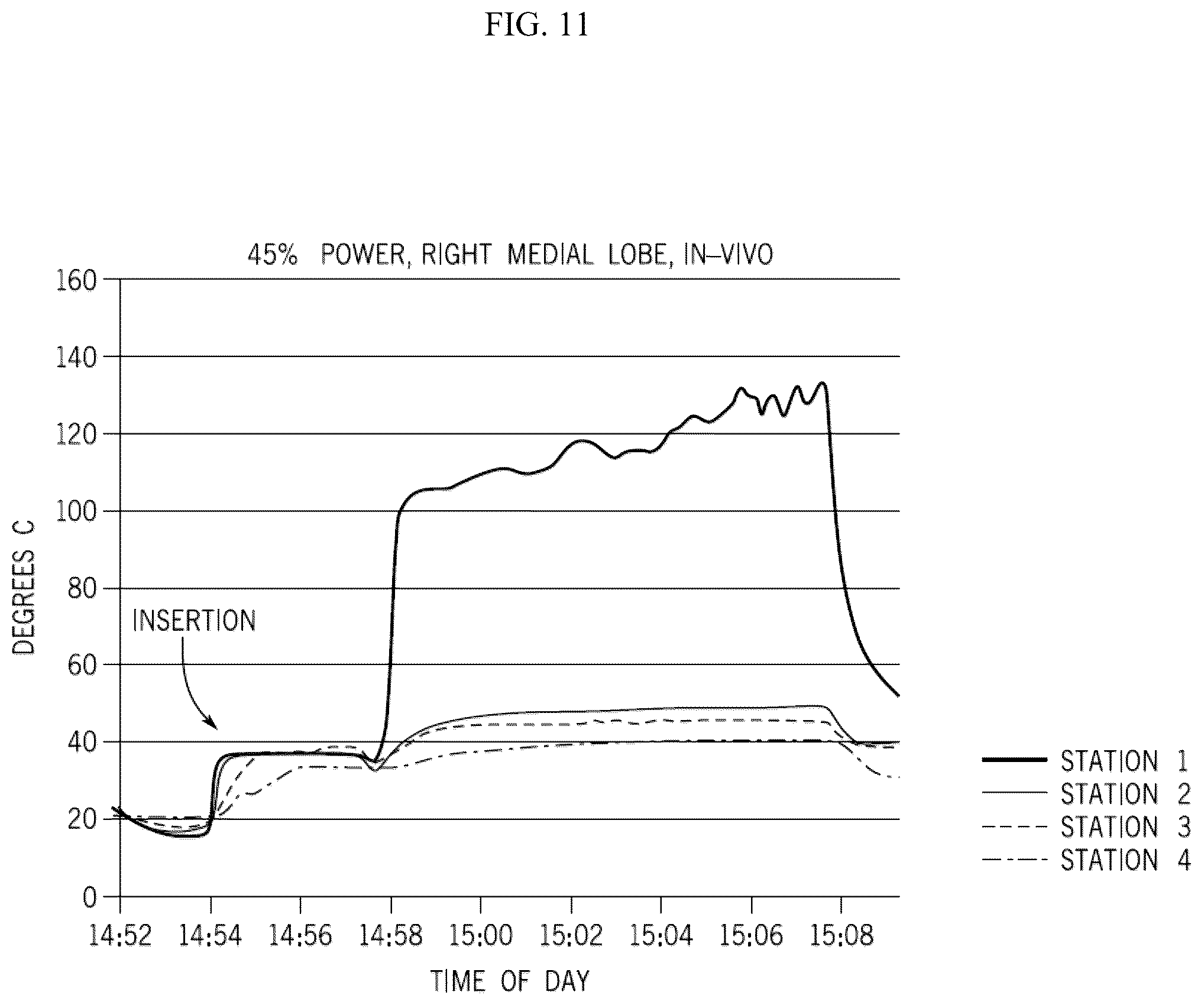 Patent US12376903 Figure 11 – Energy delivery systems and uses thereof