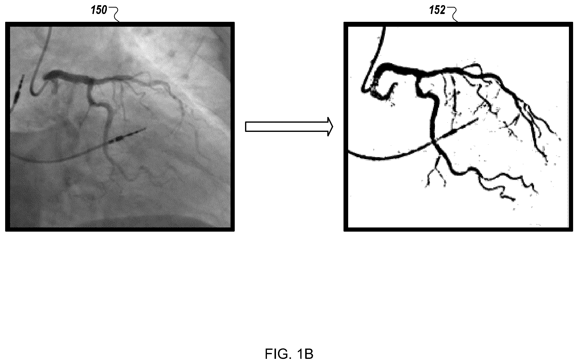 Patent US12376905 Figure 2 – Augmented reality display of surgical imaging