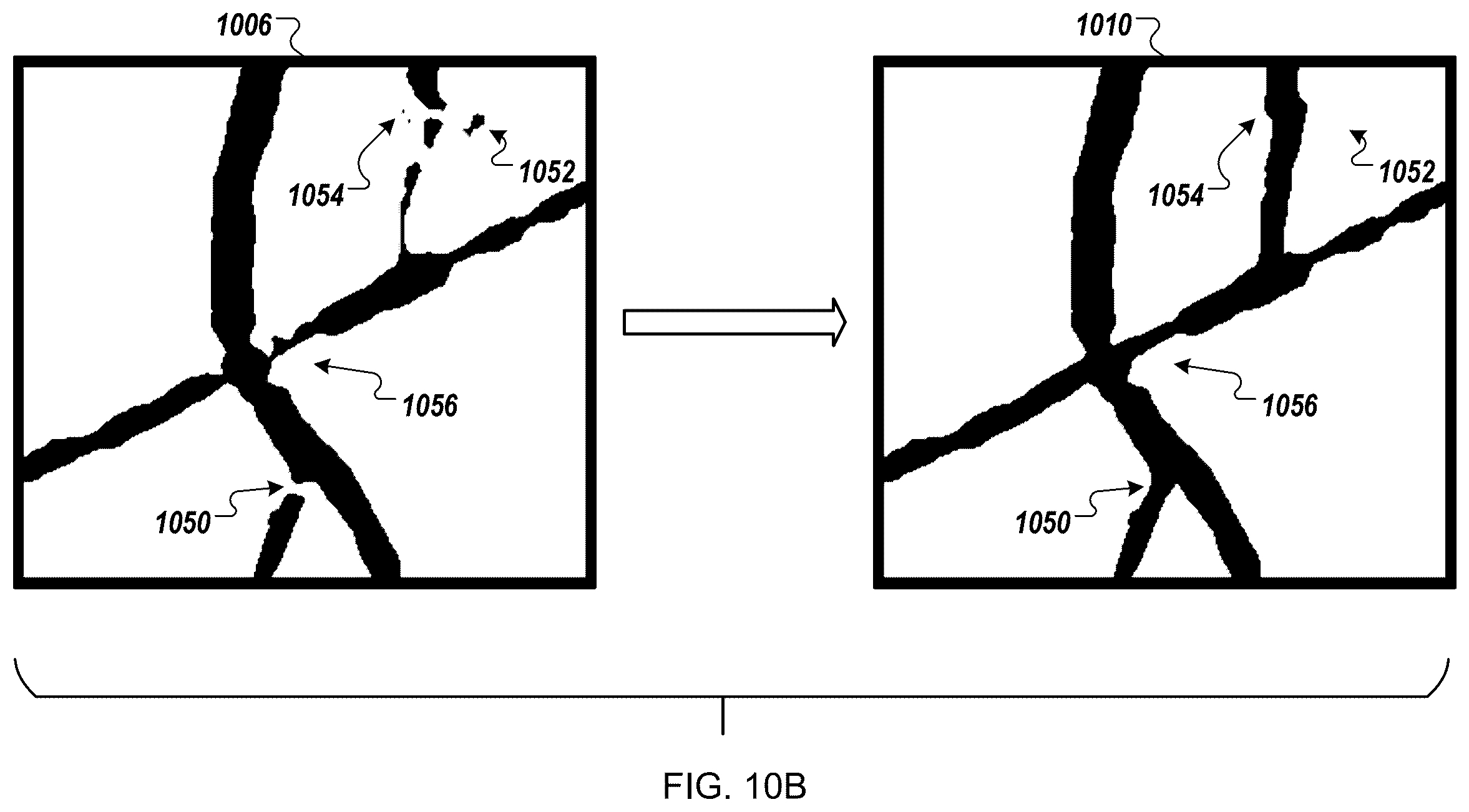 Patent US12376905 Figure 12 – Augmented reality display of surgical imaging