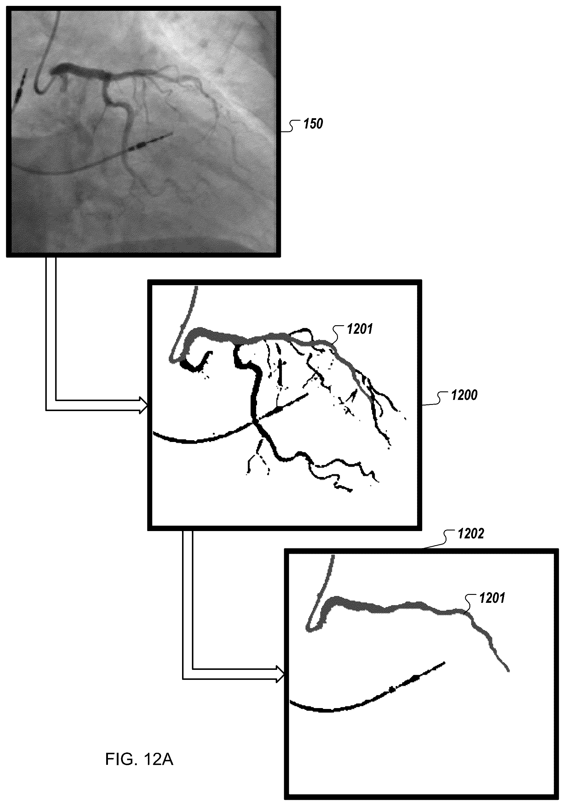 Patent US12376905 Figure 14 – Augmented reality display of surgical imaging