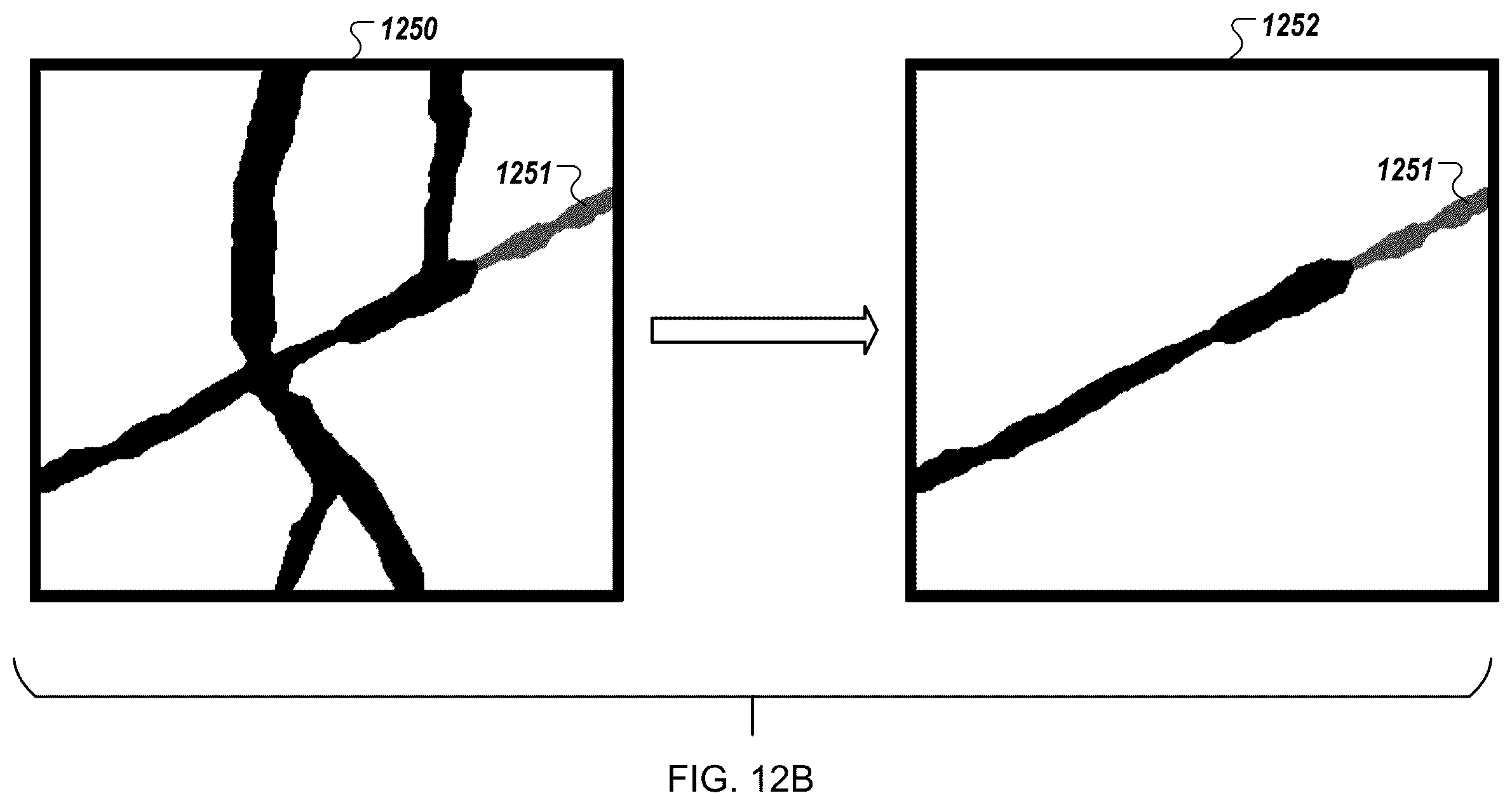 Patent US12376905 Figure 15 – Augmented reality display of surgical imaging