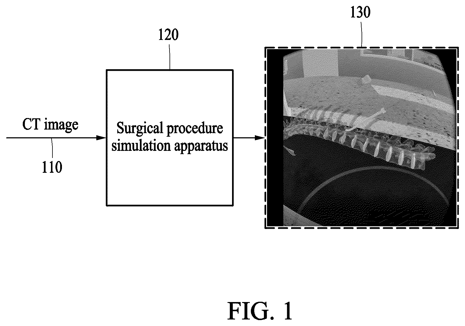 Patent US12376906 Figure 1 – Method and apparatus for surgical procedure simulation based on virtual reality