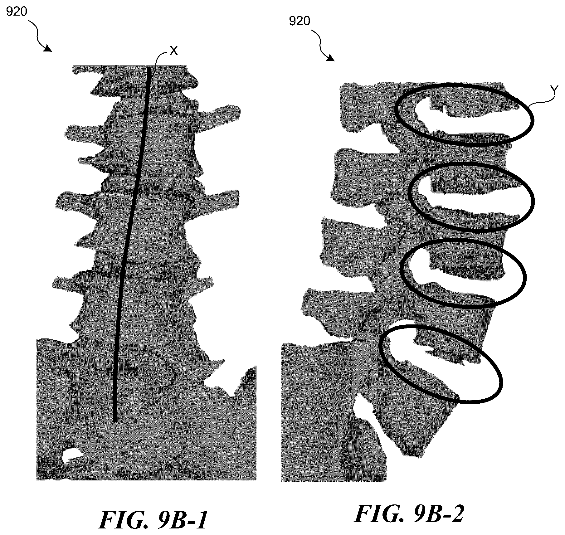 Patent US12376907 Figure 14 – Patient-specific medical systems, devices, and methods