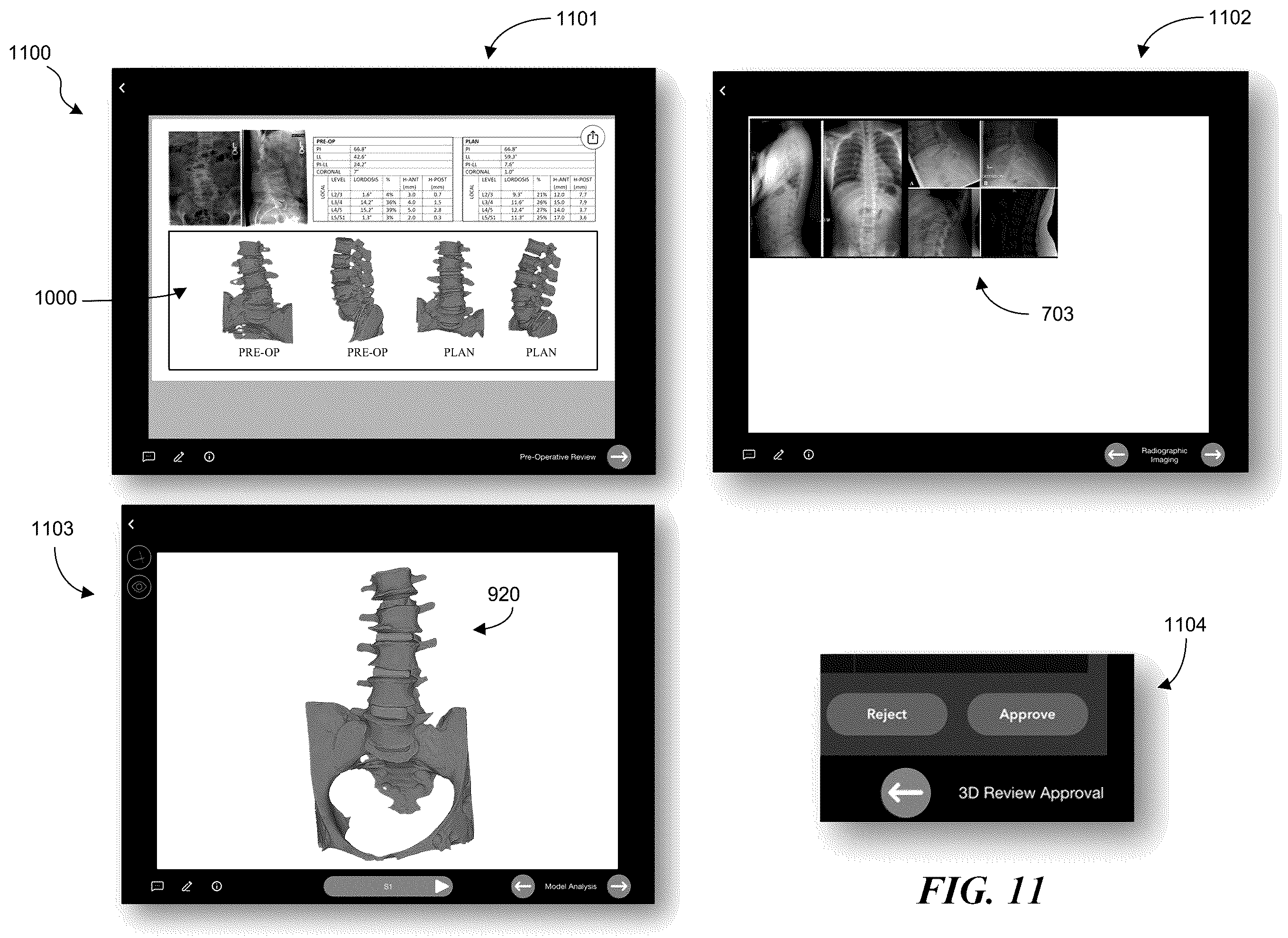 Patent US12376907 Figure 16 – Patient-specific medical systems, devices, and methods