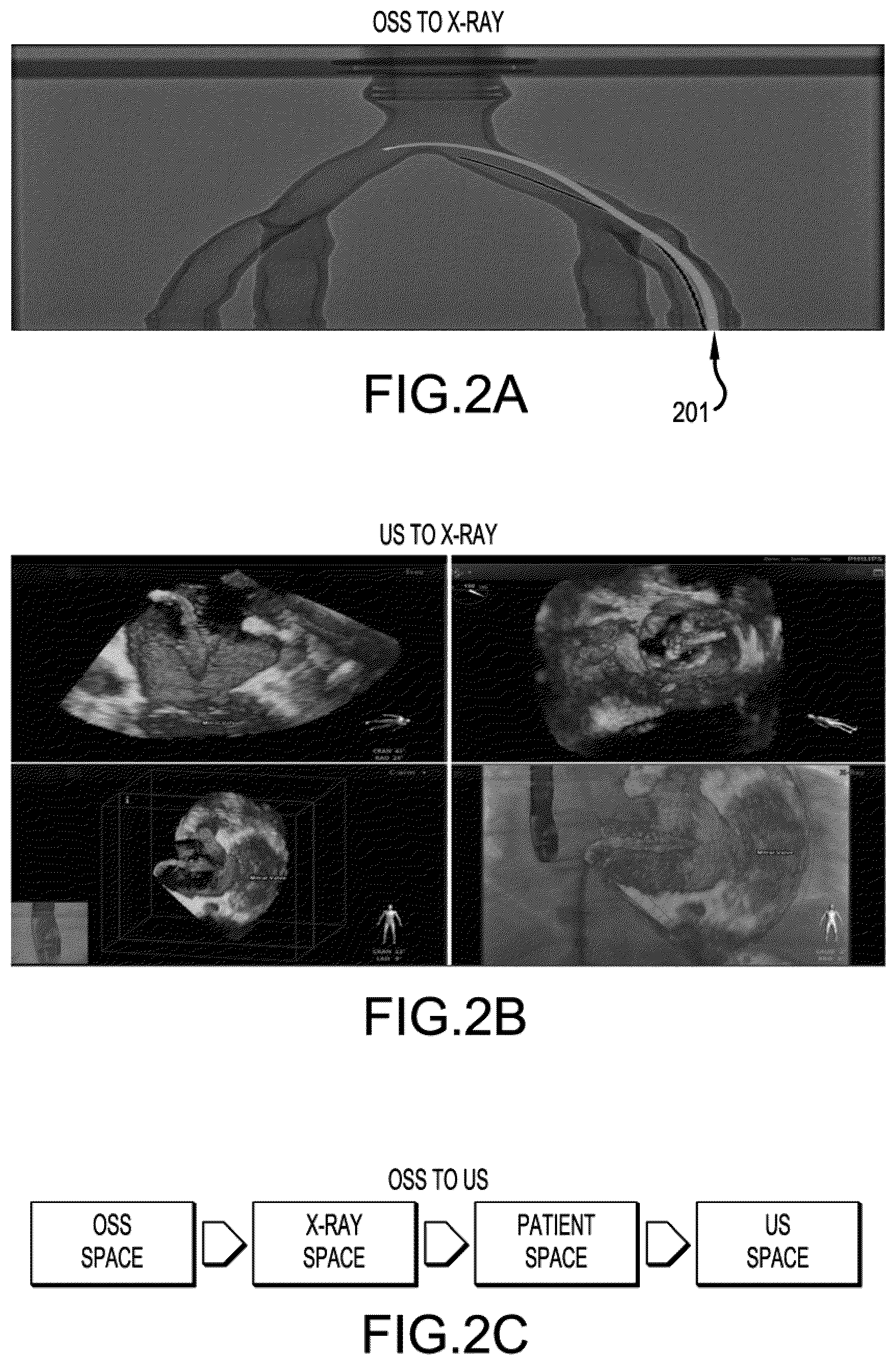 Patent US12376911 Figure 2 – Interventional medical device tracking