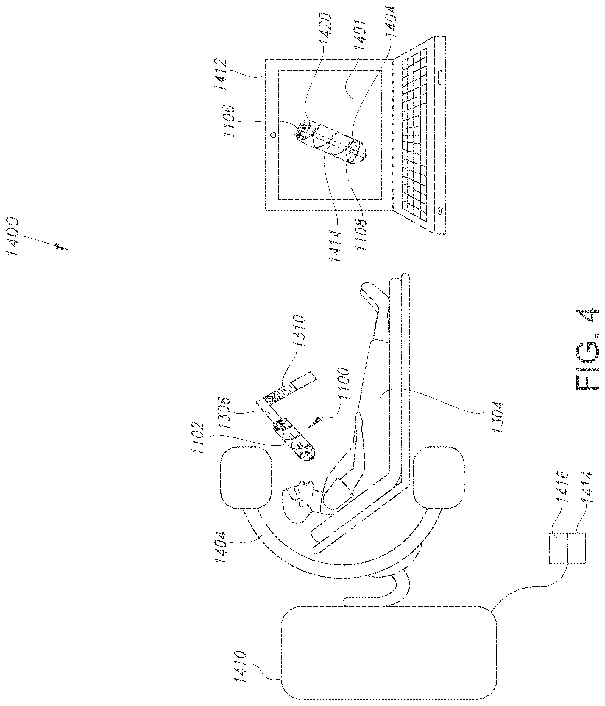 Patent US12376913 Figure 4 – Three-dimensional dual fiducial-sensor trackable device and method of use