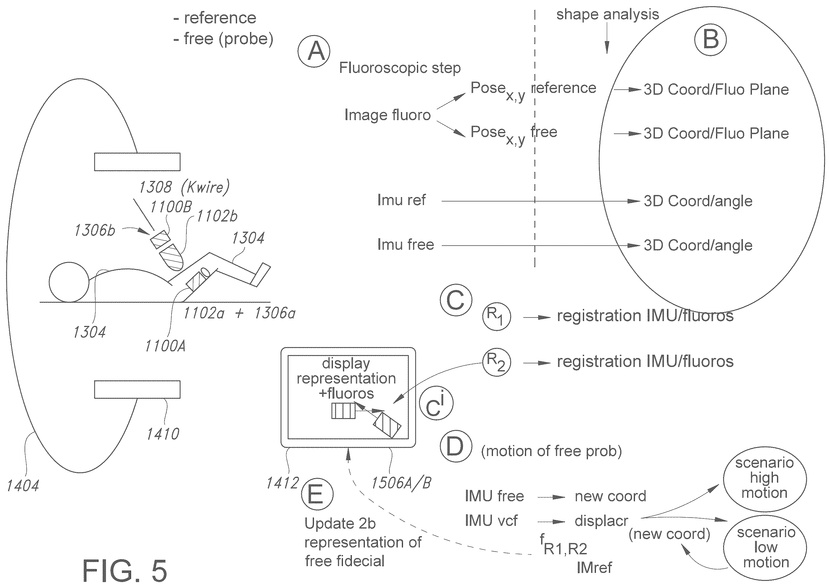 Patent US12376913 Figure 5 – Three-dimensional dual fiducial-sensor trackable device and method of use