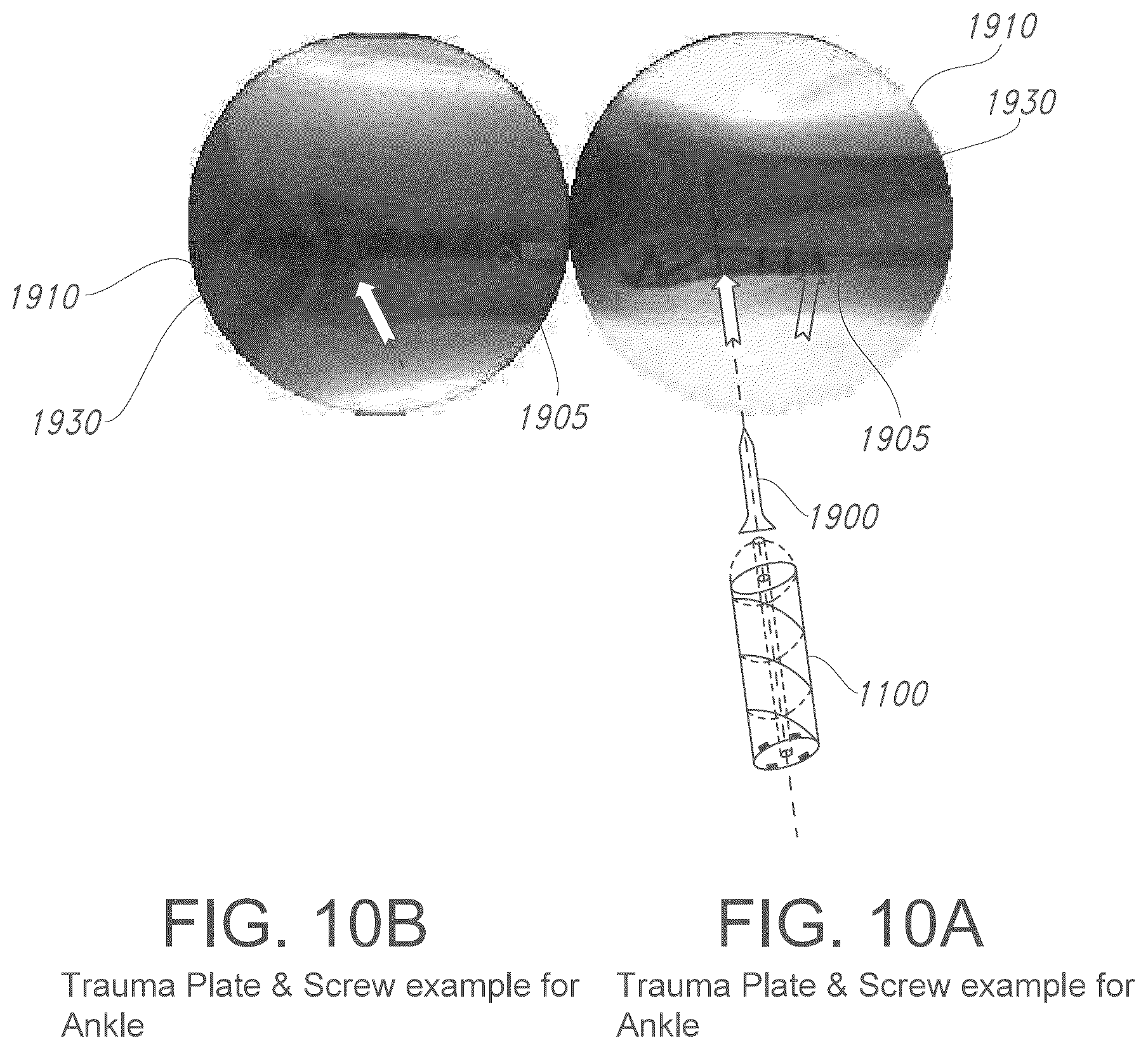 Patent US12376913 Figure 10 – Three-dimensional dual fiducial-sensor trackable device and method of use