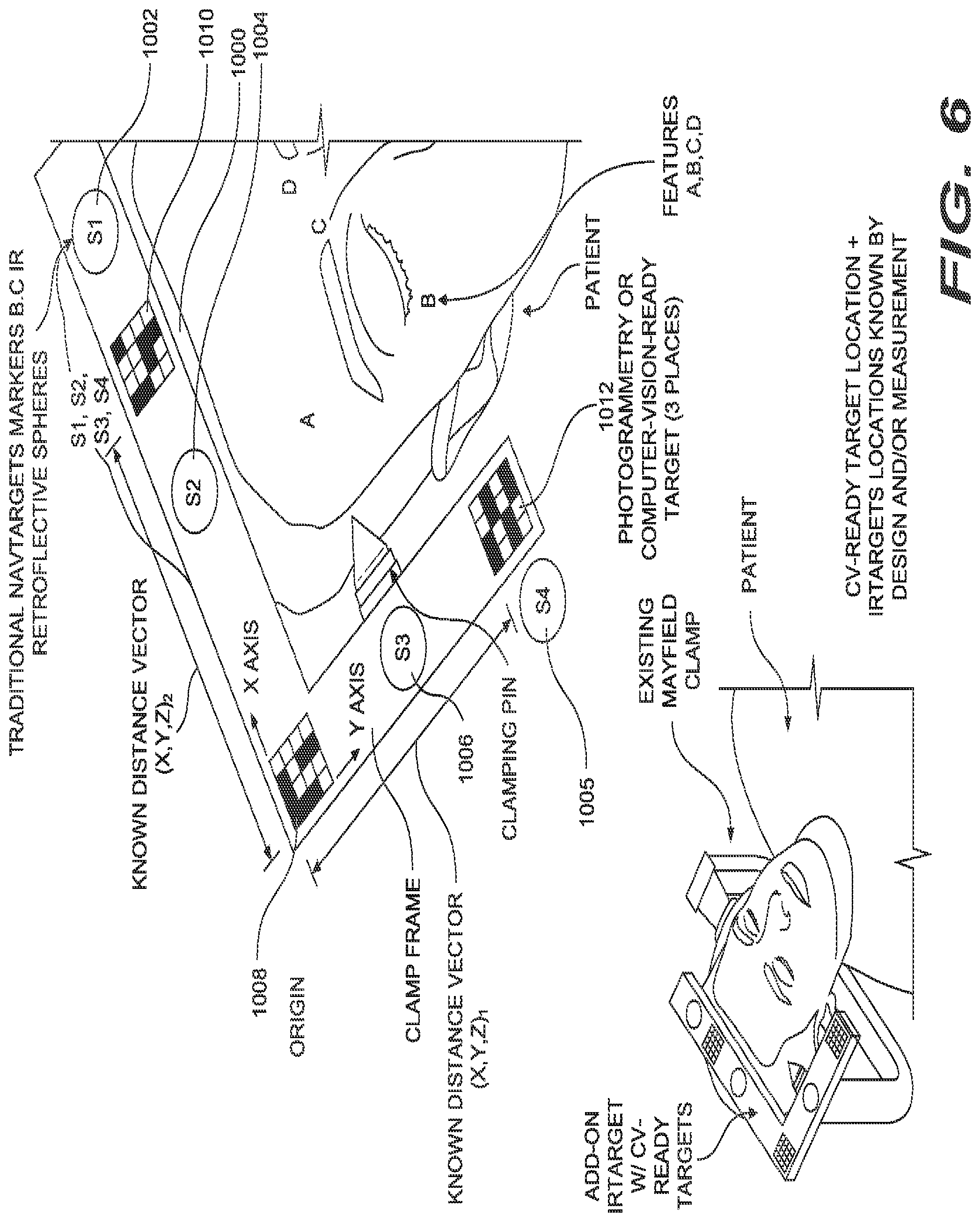 Patent US12376915 Figure 9 – Automated touchless registration for surgical navigation