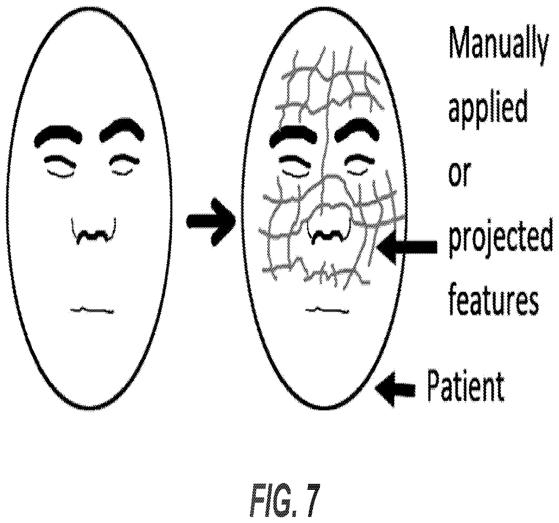 Patent US12376915 Figure 10 – Automated touchless registration for surgical navigation