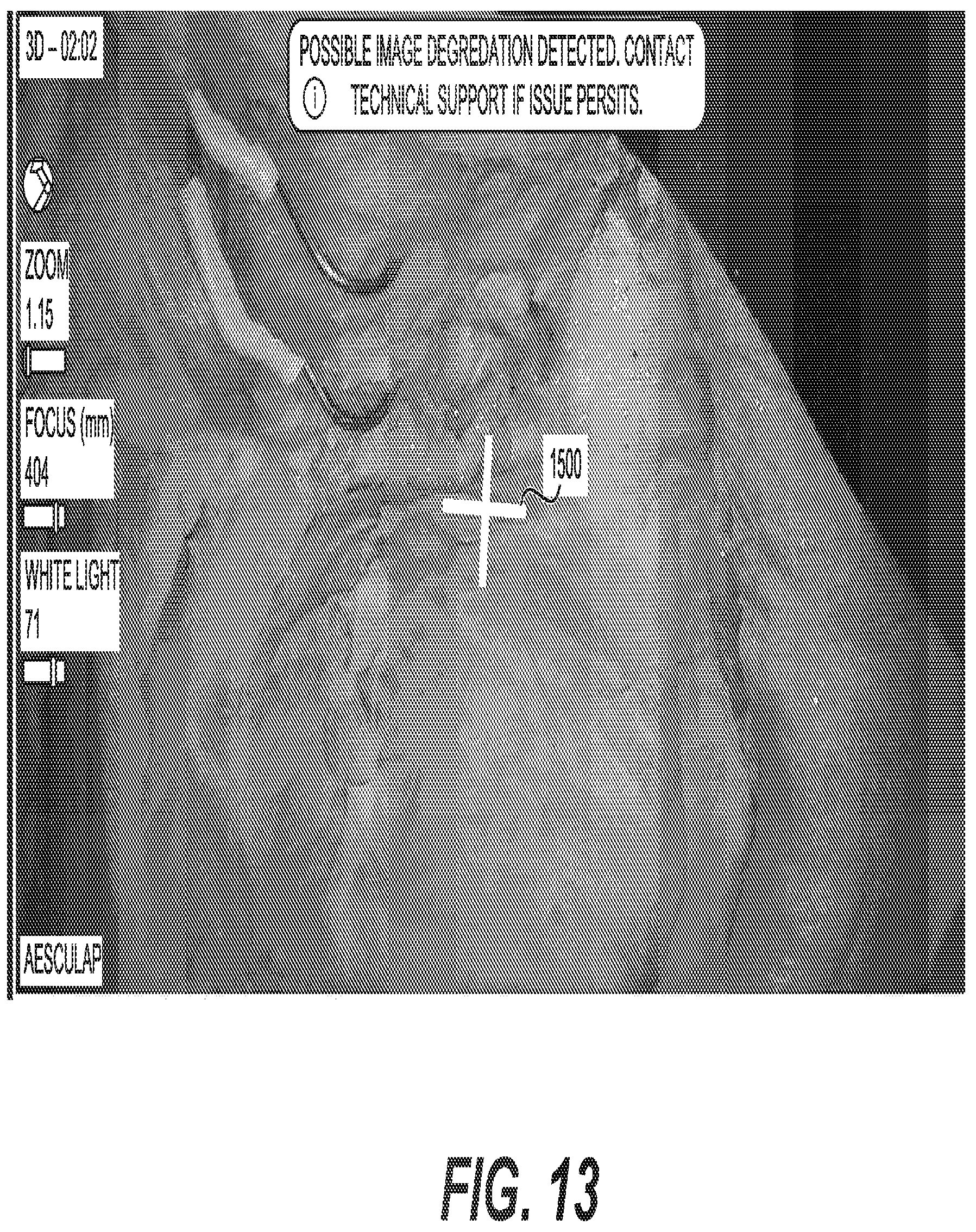 Patent US12376915 Figure 16 – Automated touchless registration for surgical navigation