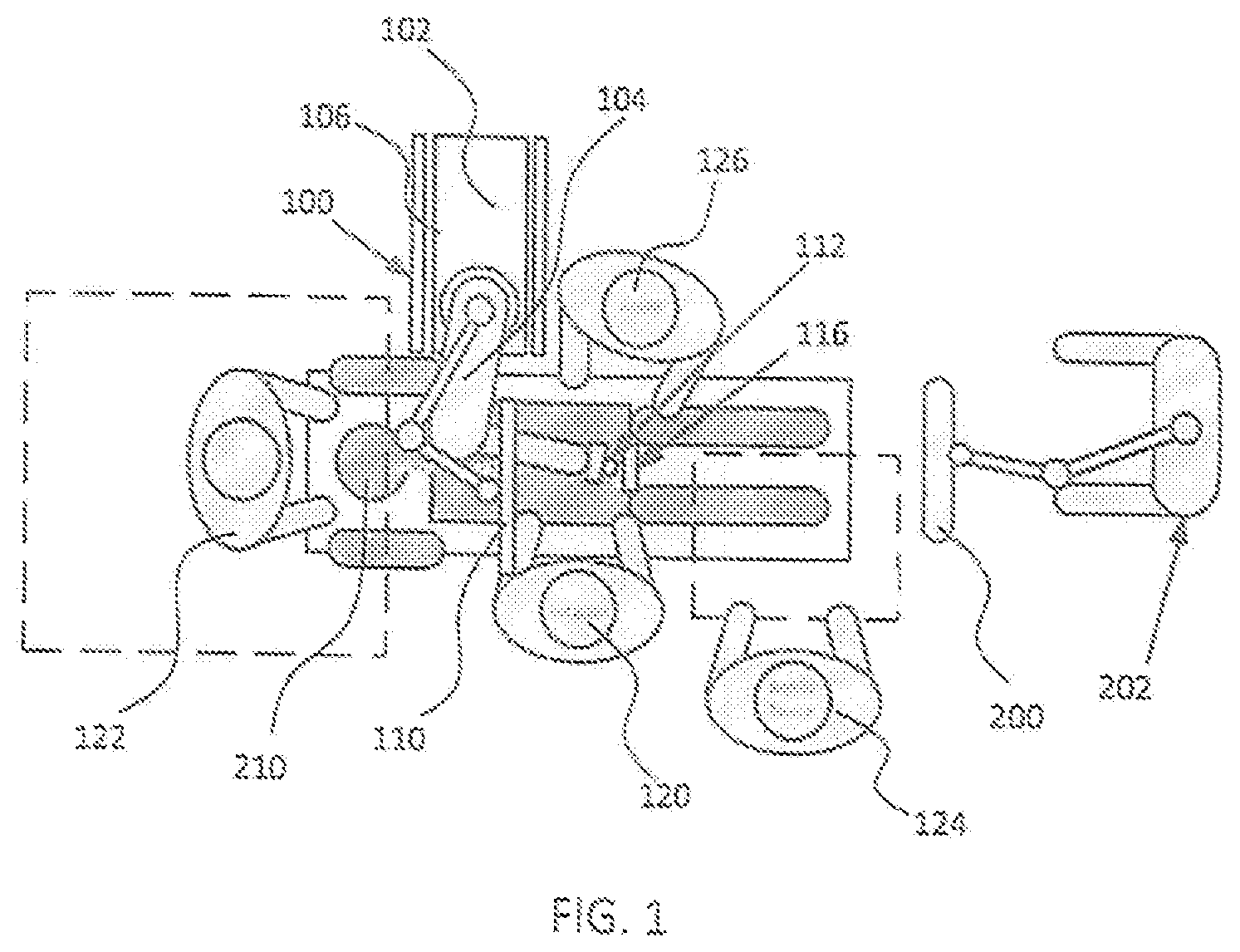 Patent US12376916 Figure 1 – System for a surveillance marker in robotic-assisted surgery