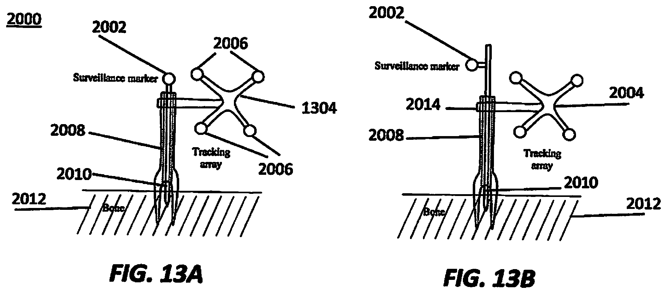 Patent US12376916 Figure 13 – System for a surveillance marker in robotic-assisted surgery