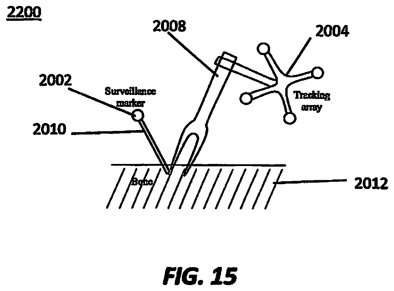 Patent US12376916 Figure 15 – System for a surveillance marker in robotic-assisted surgery