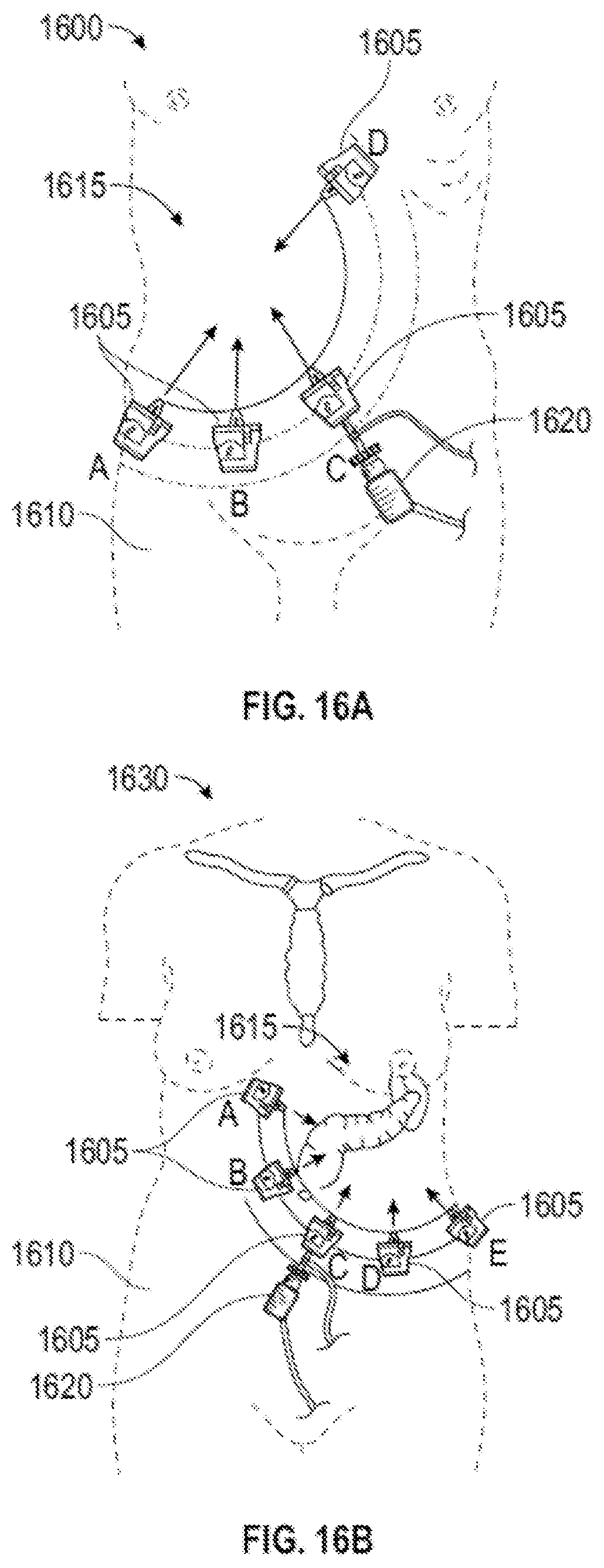 Patent US12376918 Figure 16 – Systems and techniques for providing multiple perspectives during medical procedures
