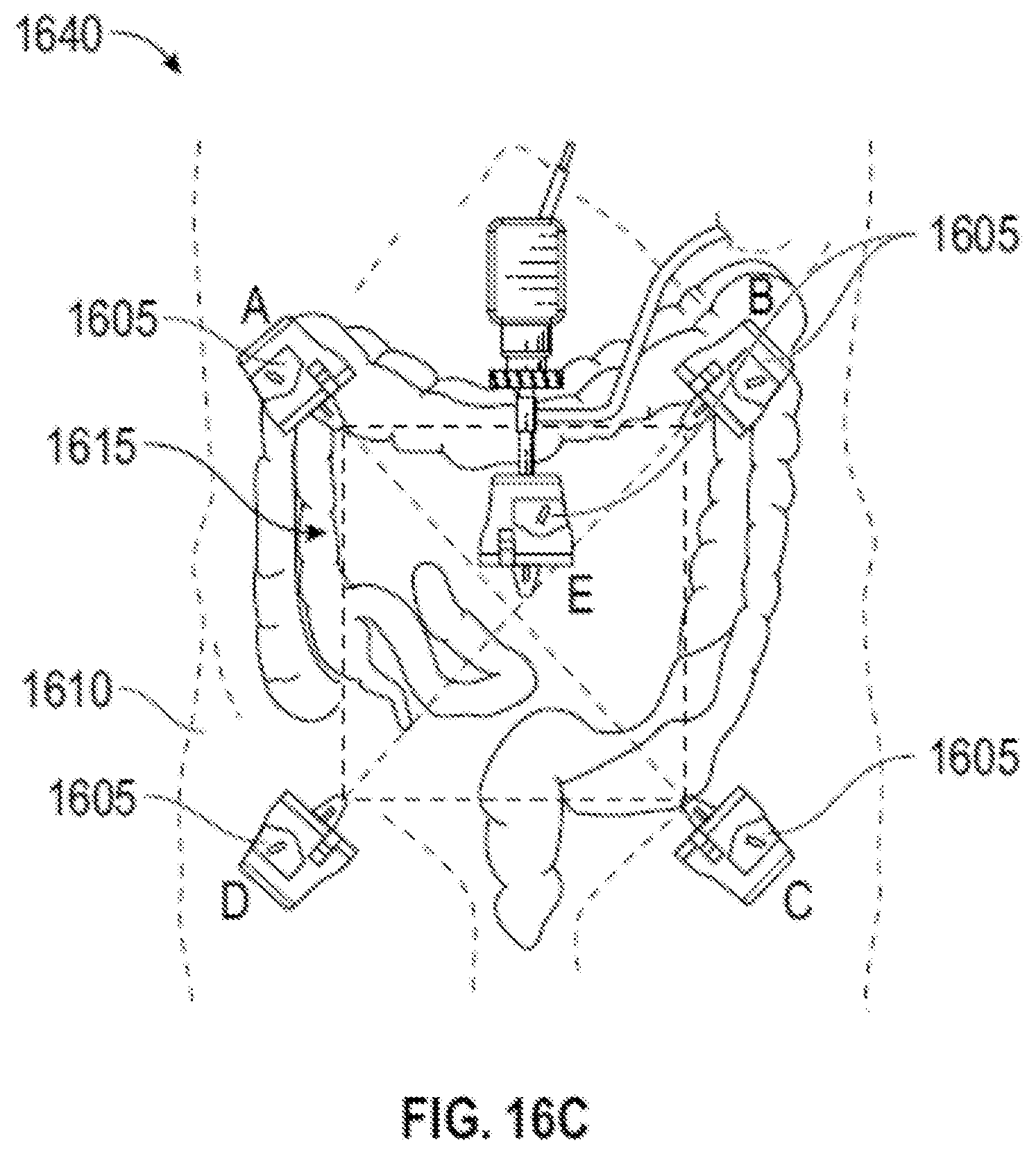 Patent US12376918 Figure 17 – Systems and techniques for providing multiple perspectives during medical procedures